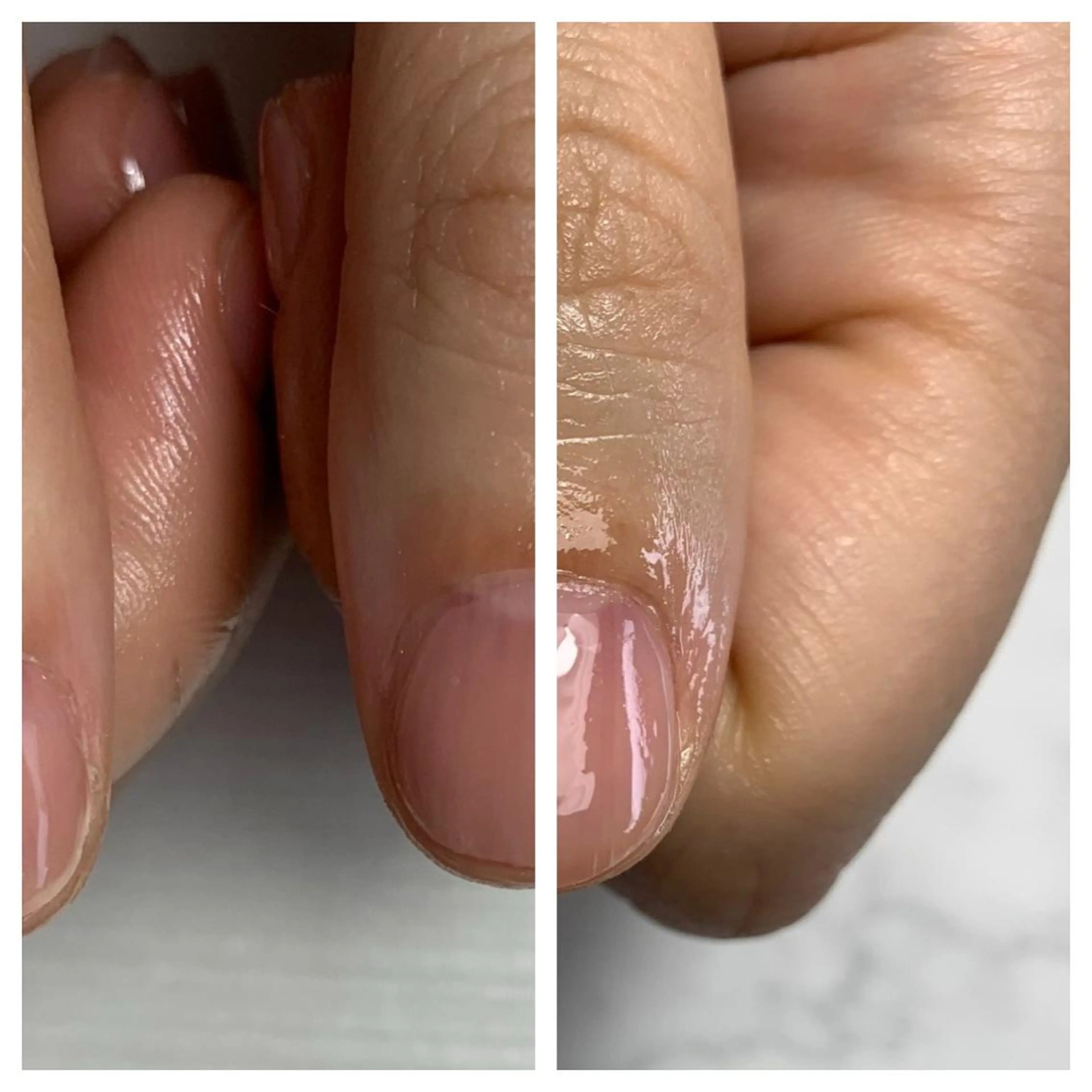 ネイル 大橋 愛のエステ・リラクイメージ