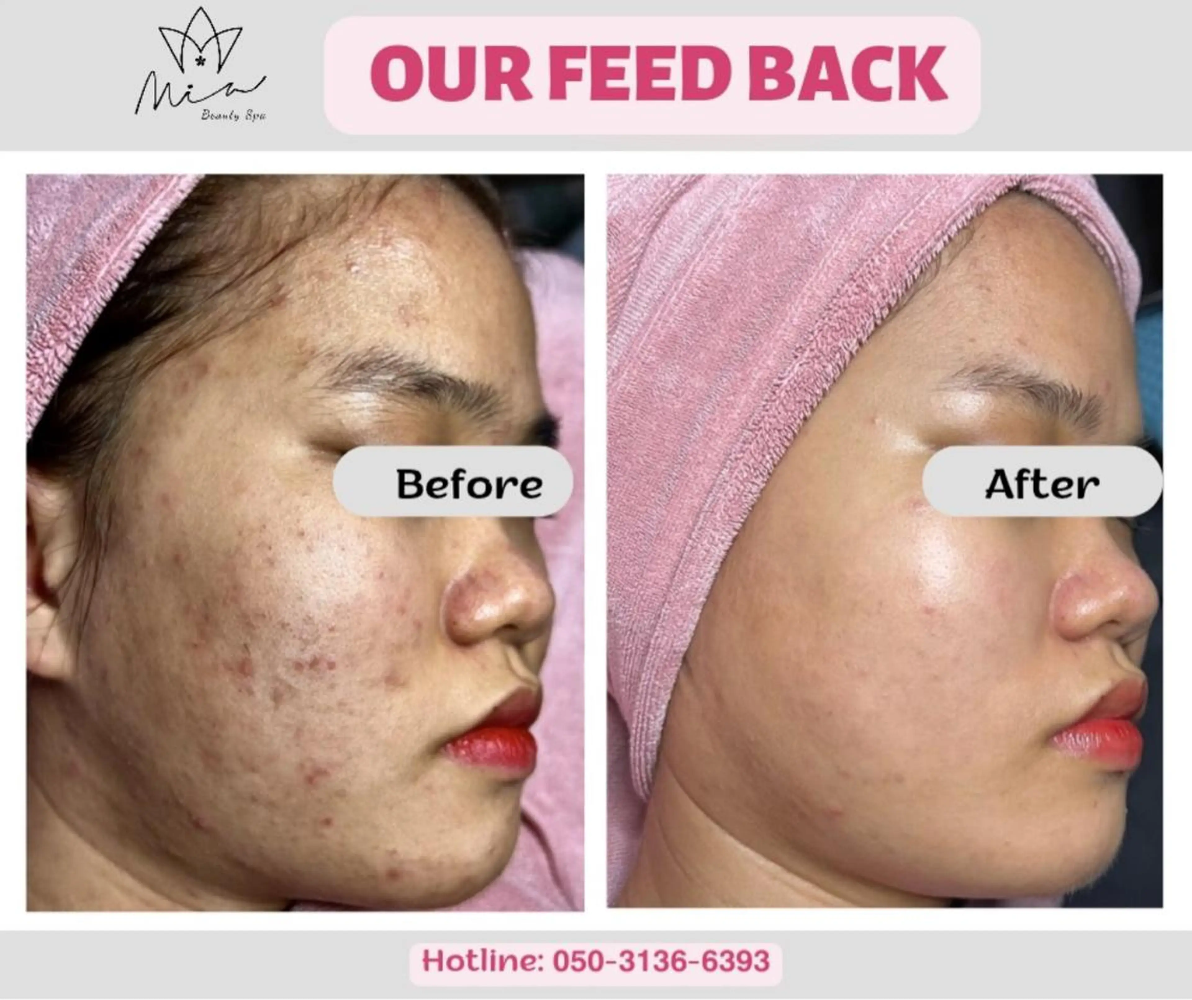 Mia beauty所属・MiA Beautyのエステ・リラクイメージ