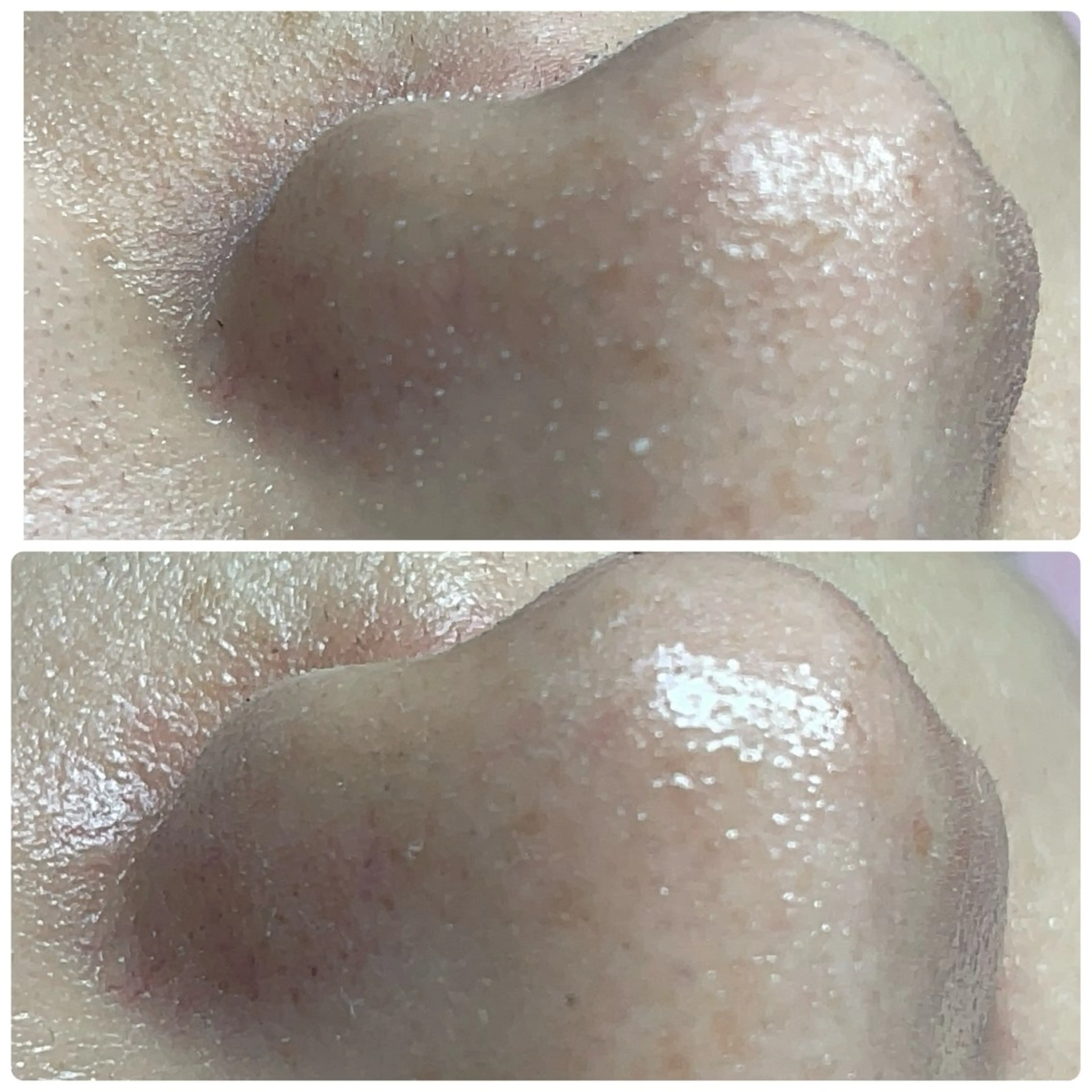 エステ Chalon所属・REVI取扱・肌悩み 毛穴Chalonのエステ・リラクイメージ