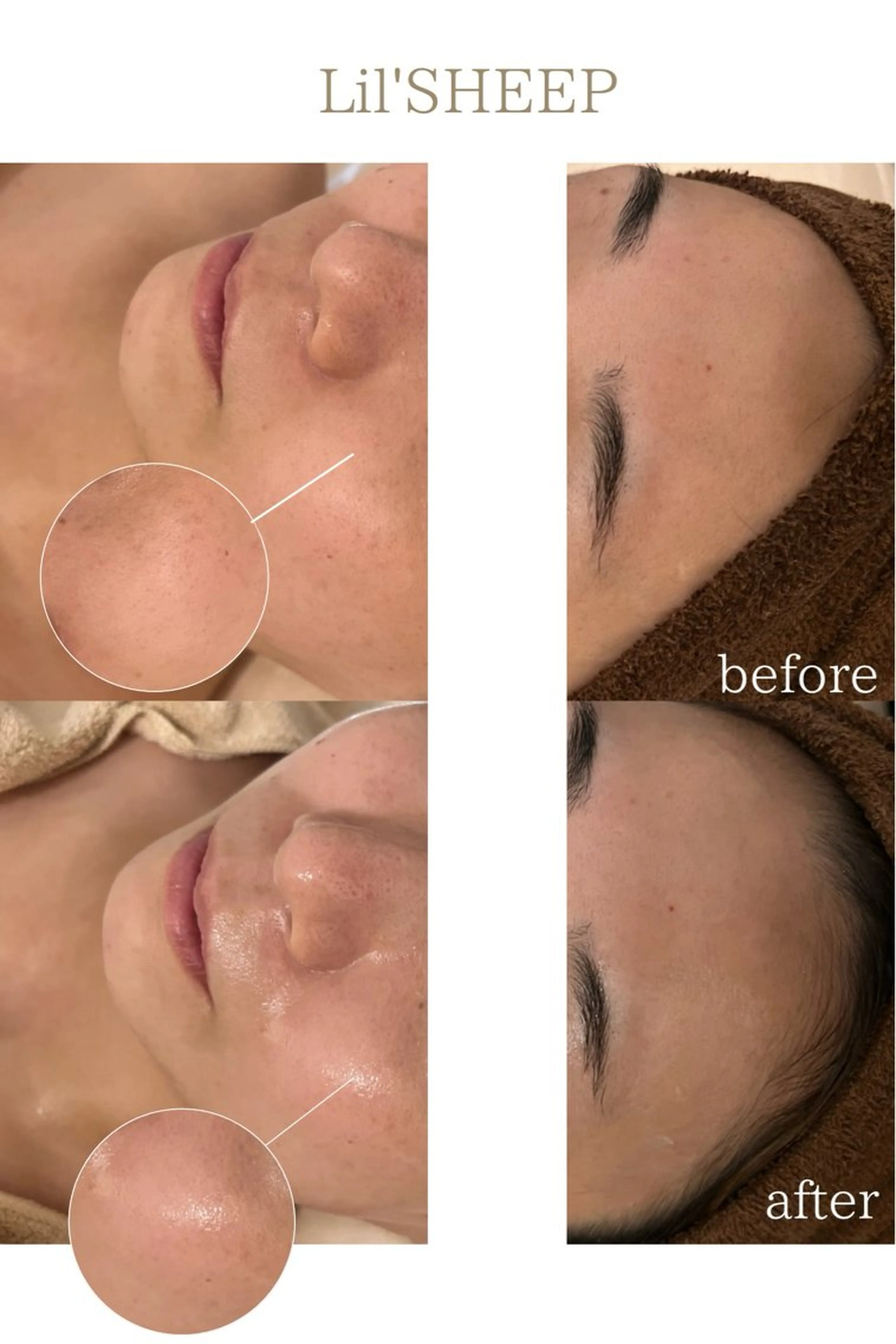 エステ 小嶋萌 今池駅徒歩2分のエステ・リラクイメージ