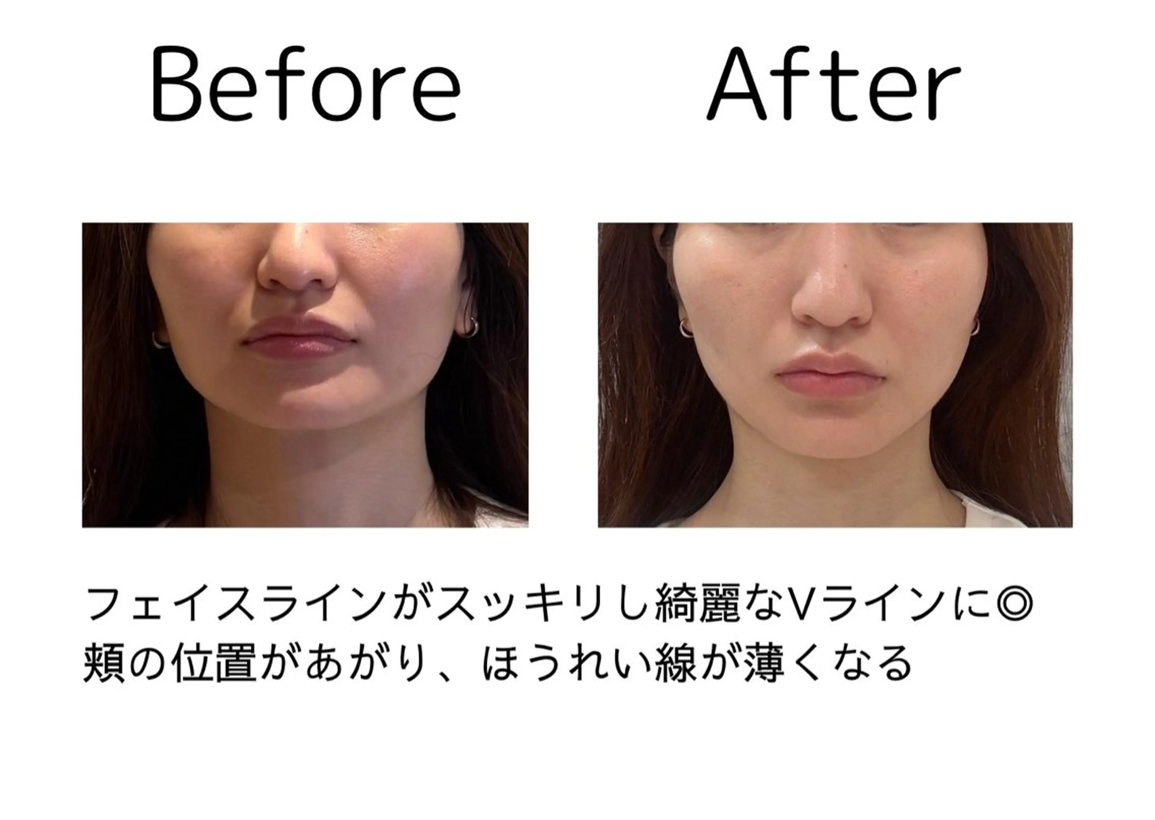 鍼灸院olina所属・鍼灸師 NARUMIのエステ・リラクイメージ