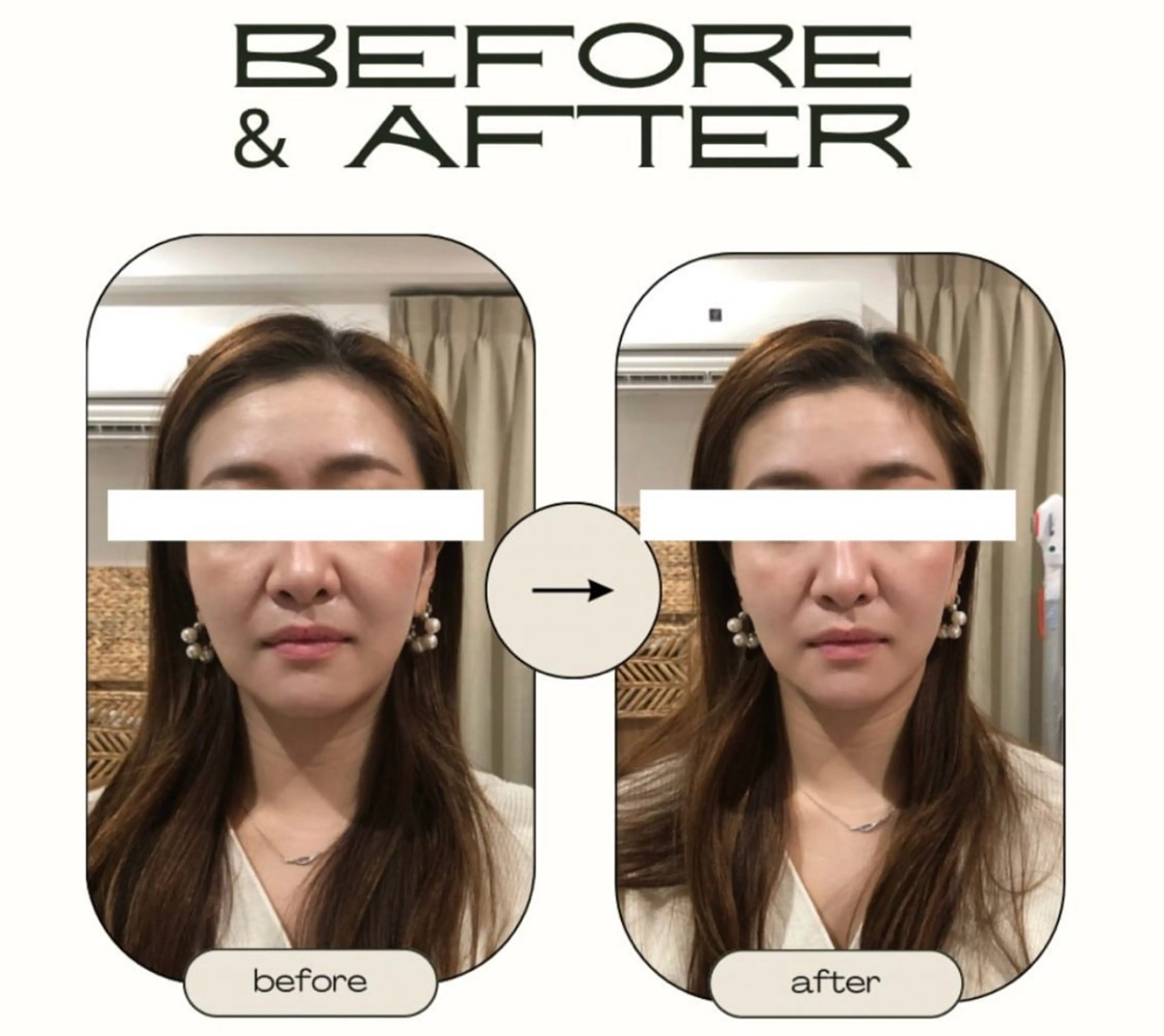 フェイシャル&ドライヘッドスパ60分　特別プラン🌿の写真