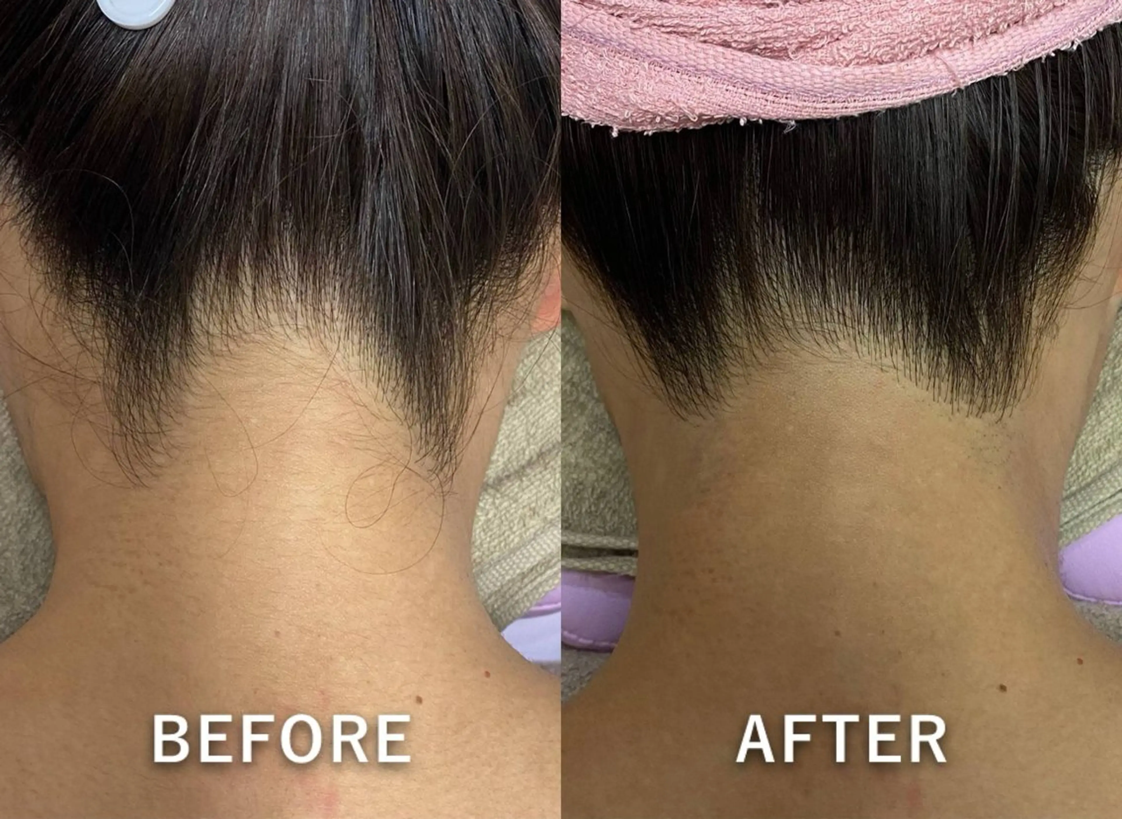 脱毛 salon de jessicaのエステ・リラクイメージ