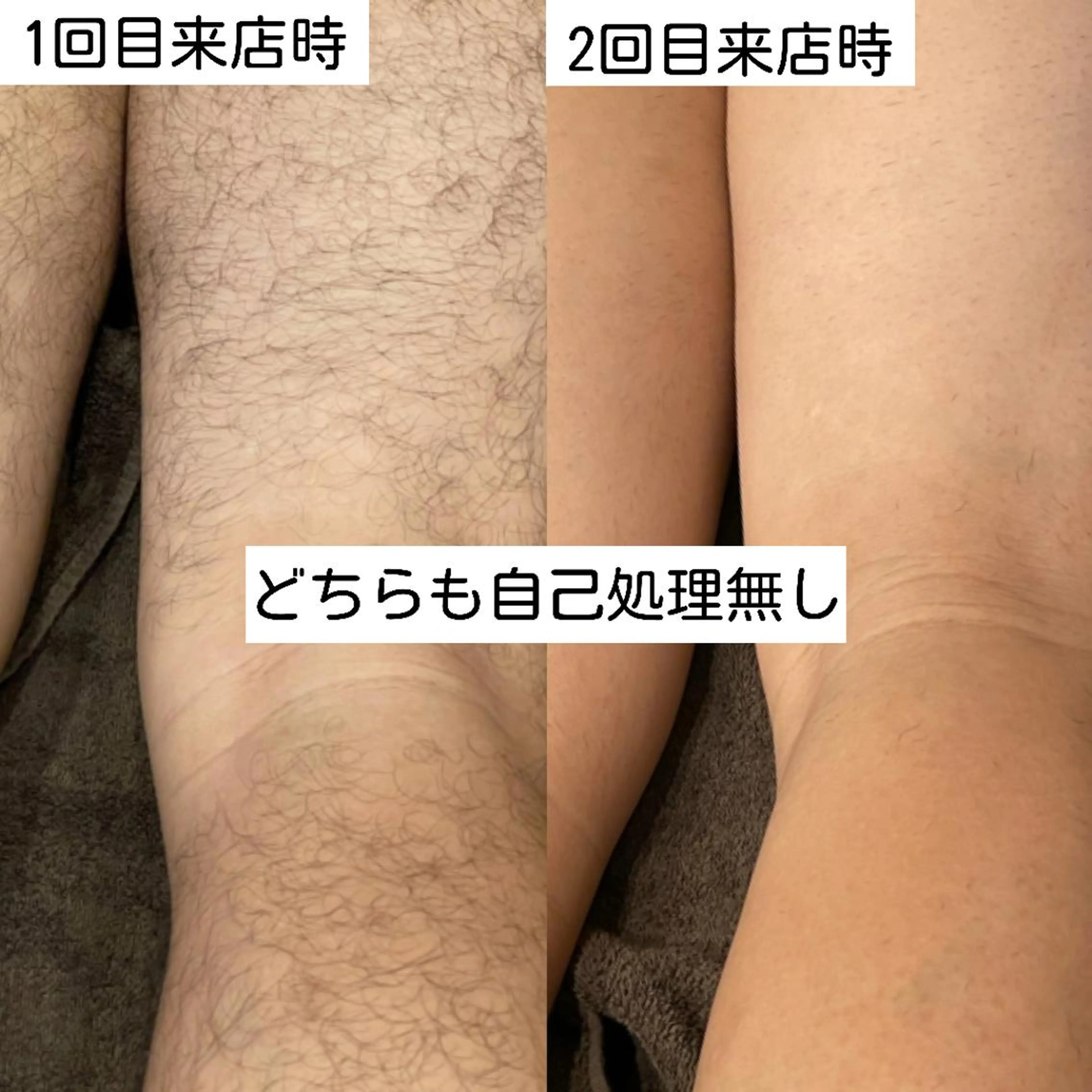 TT Beauty所属・TT Beautyの眉毛・アイブロウイメージ