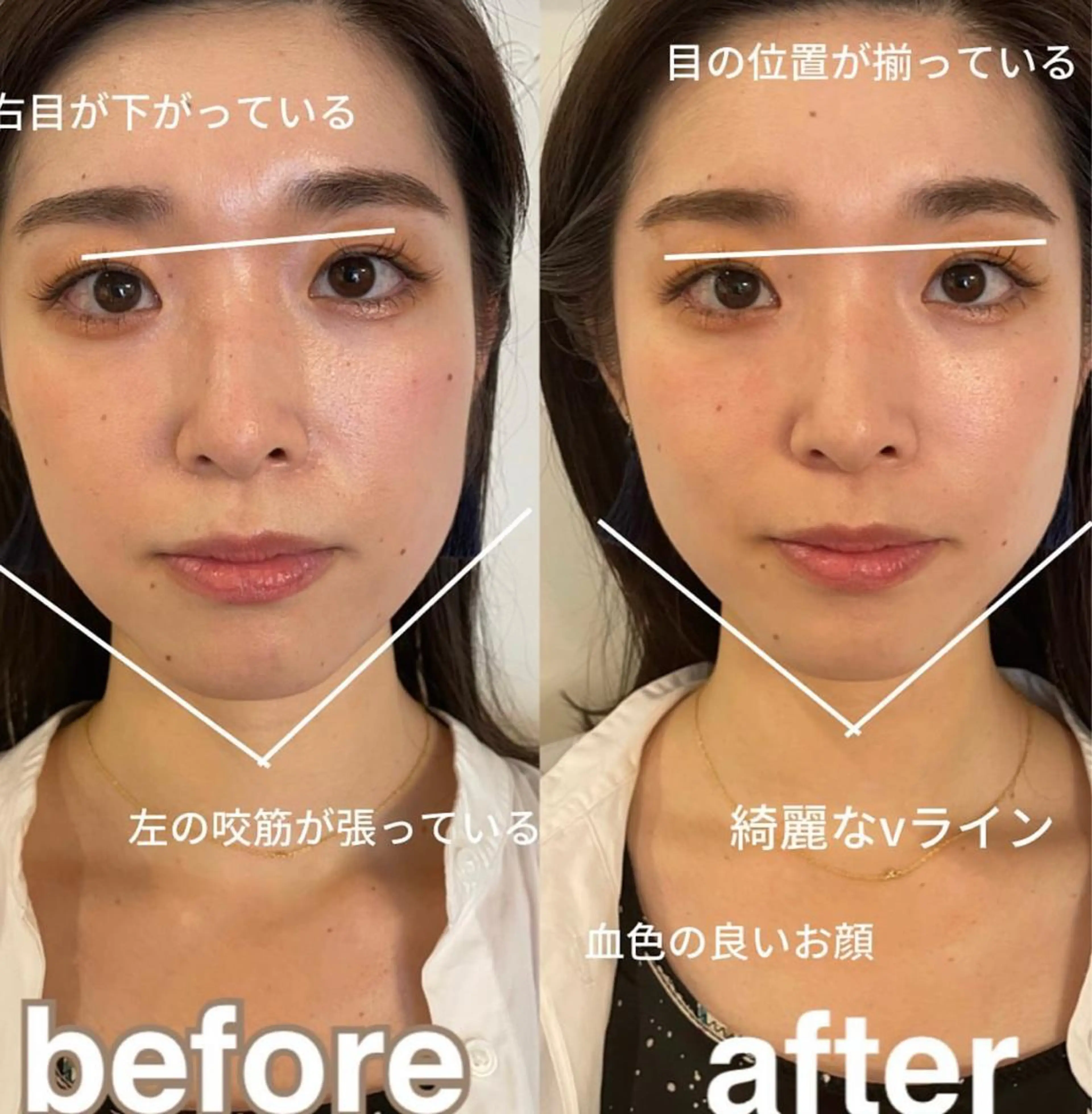 美容鍼灸サロン mahoroba院長のエステ・リラクイメージ