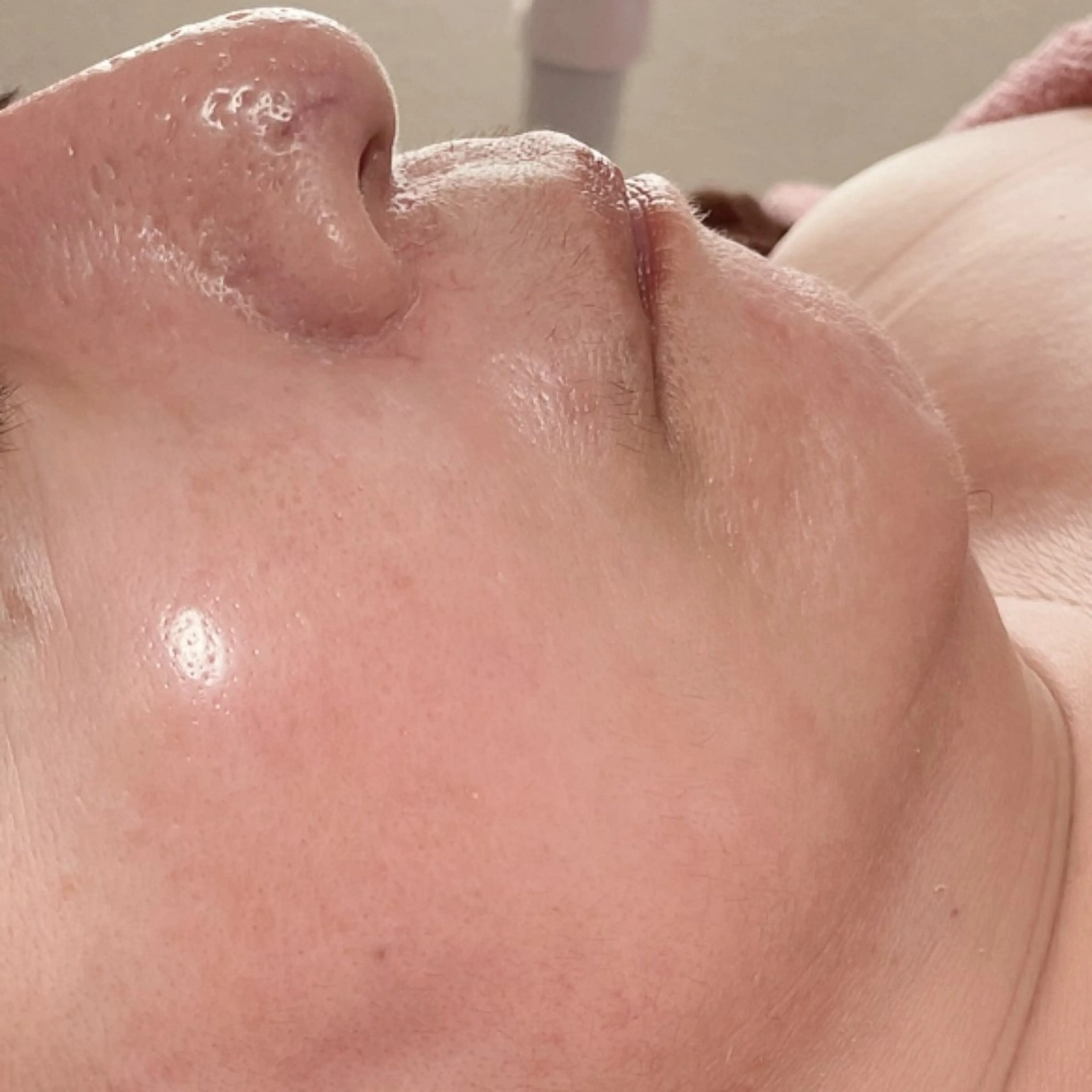 グリーンピール専門店 サロンY【大阪】のエステ・リラクイメージ