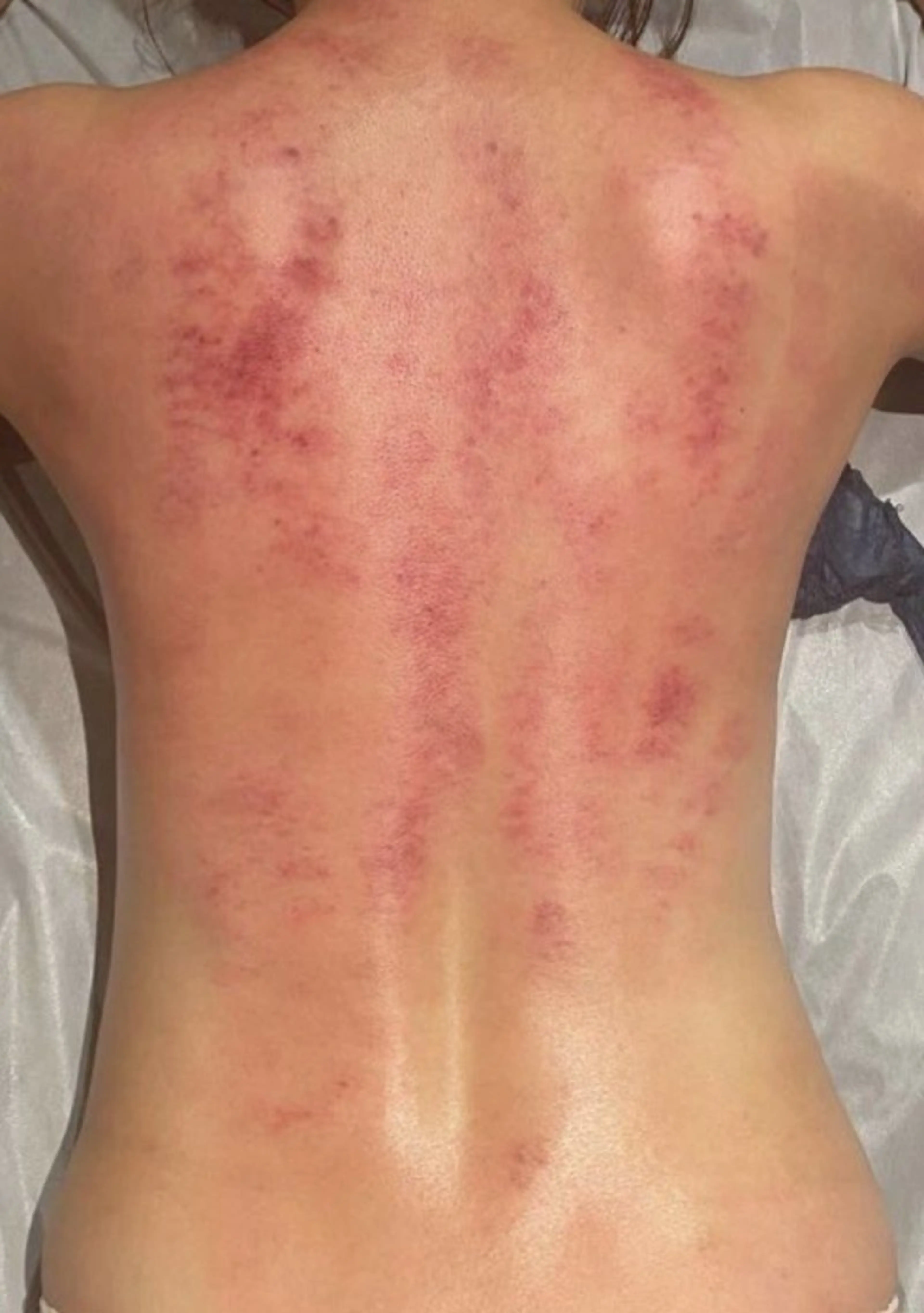 気になるブヨブヨサヨウナラ👋痛いから覚悟して🤣バキュームで揉みしだく！本気のコースの写真