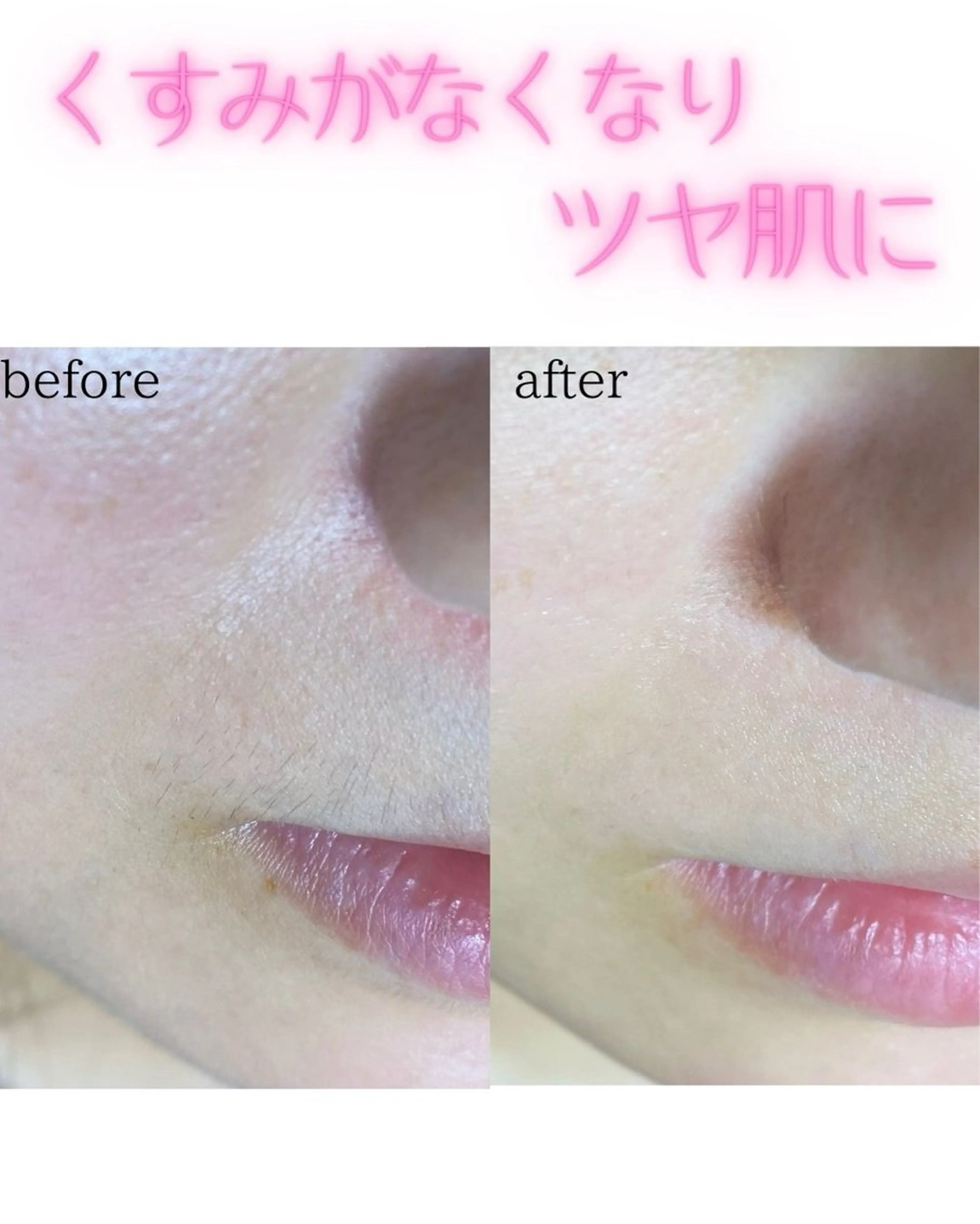 脱毛 Nao店長 /ルヴォルテ大須のマツエク・マツパデザイン