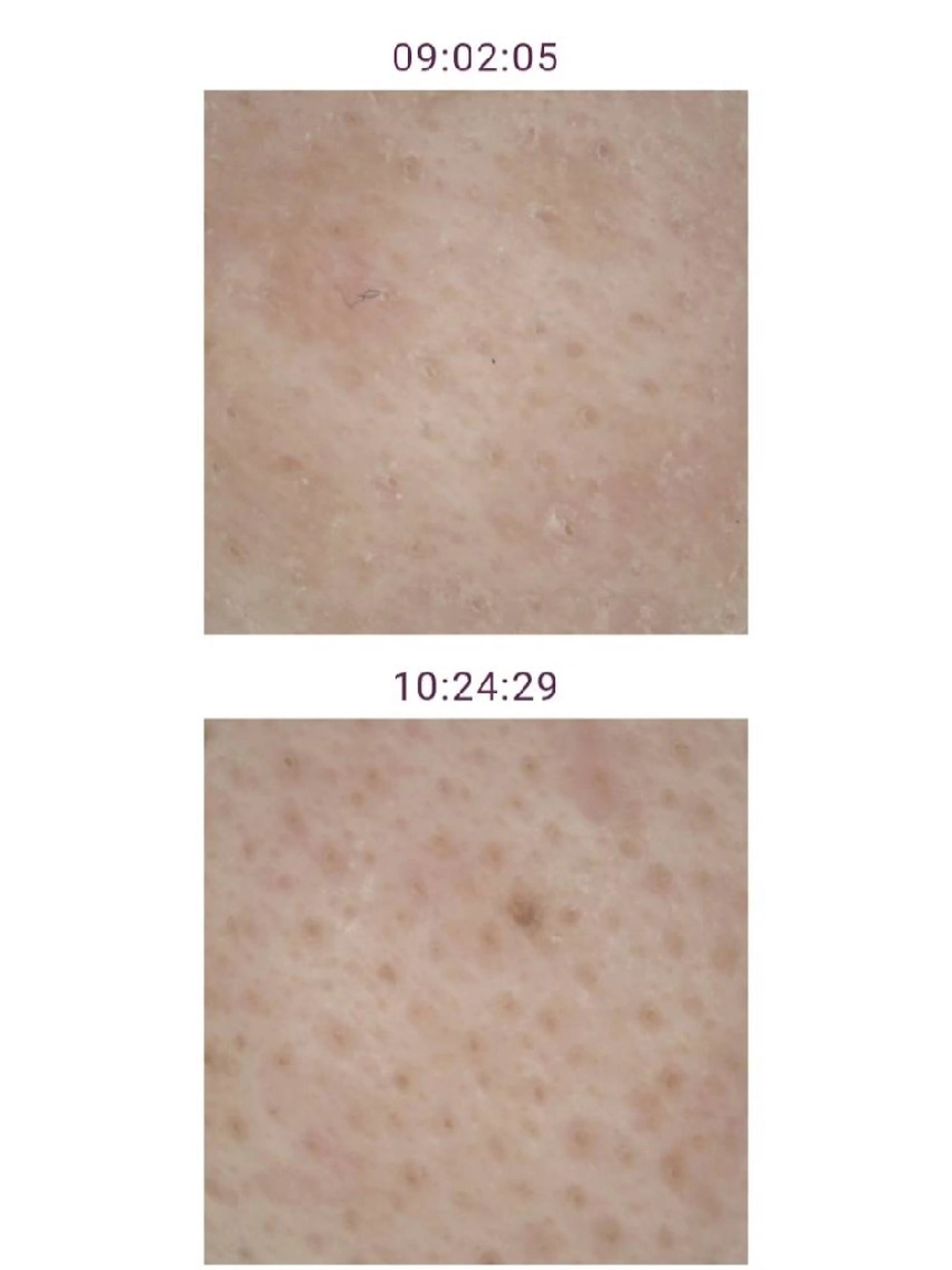 メナードフェイシャルサロンライズミュー所属・鈴木 由美のエステ・リラクイメージ