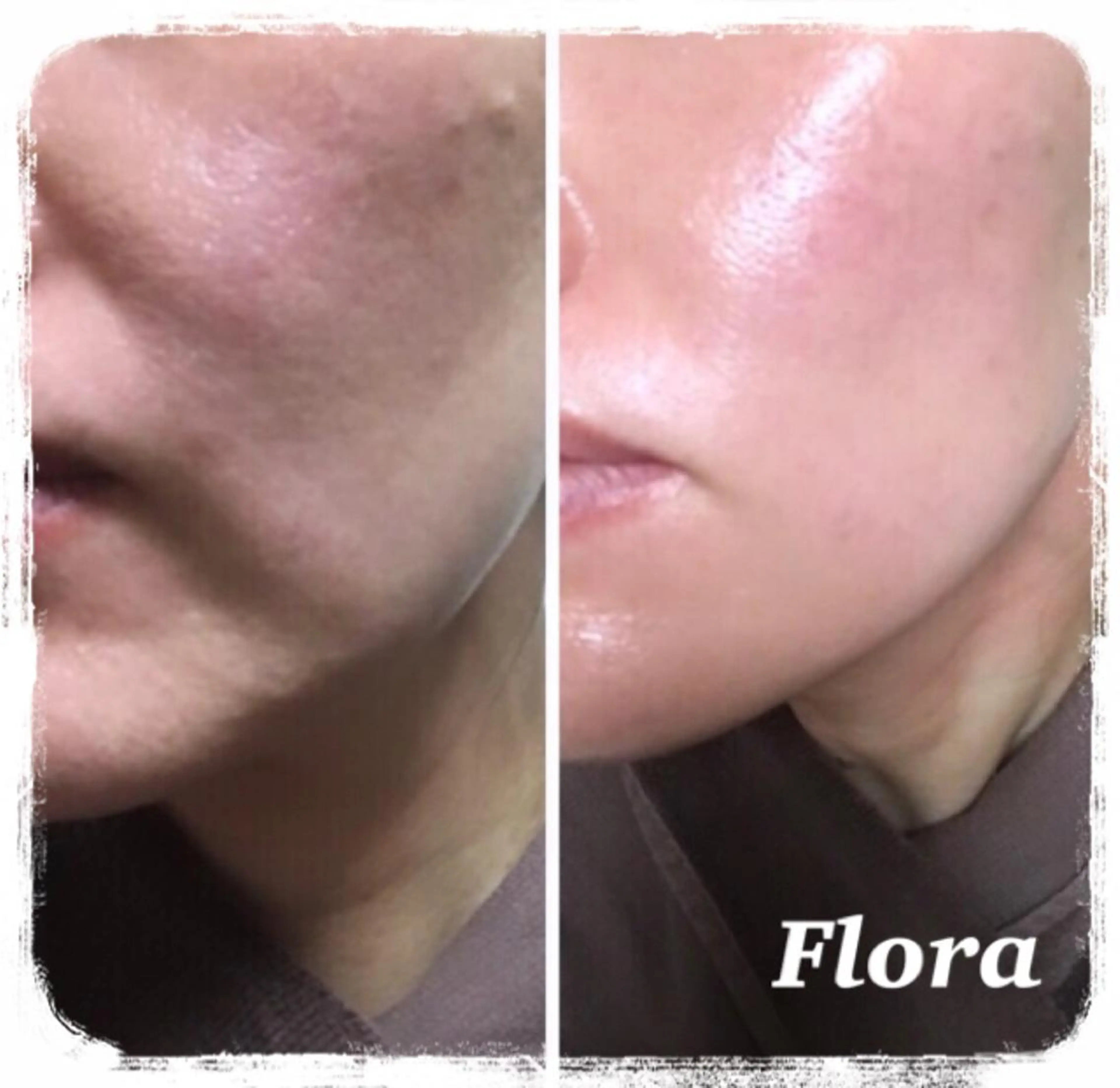 温活痩身エステ Floraのエステ・リラクイメージ