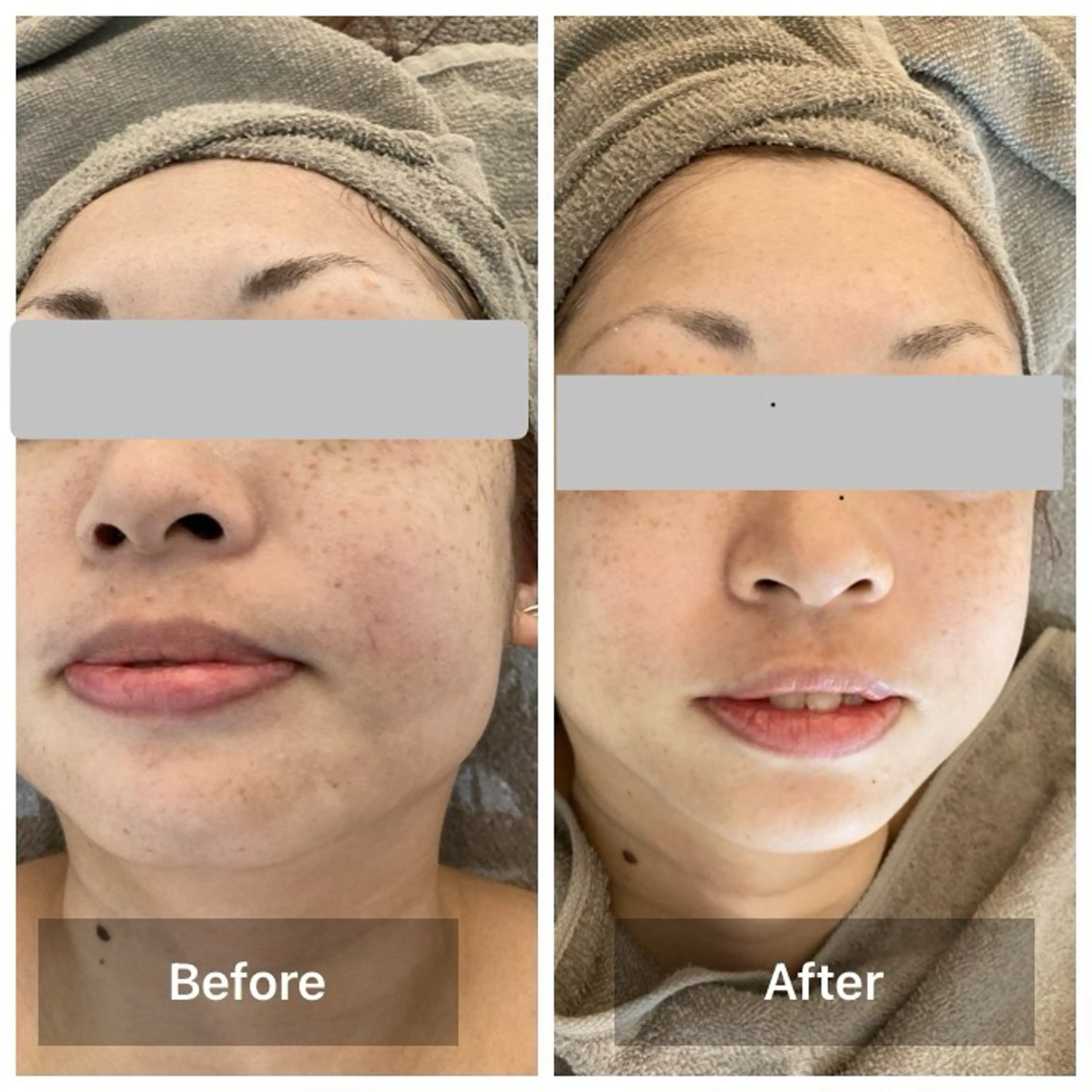 エステ リラク 目元・まつパ・美肌フ ェイシャル谷町四丁目のマツエク・マツパデザイン