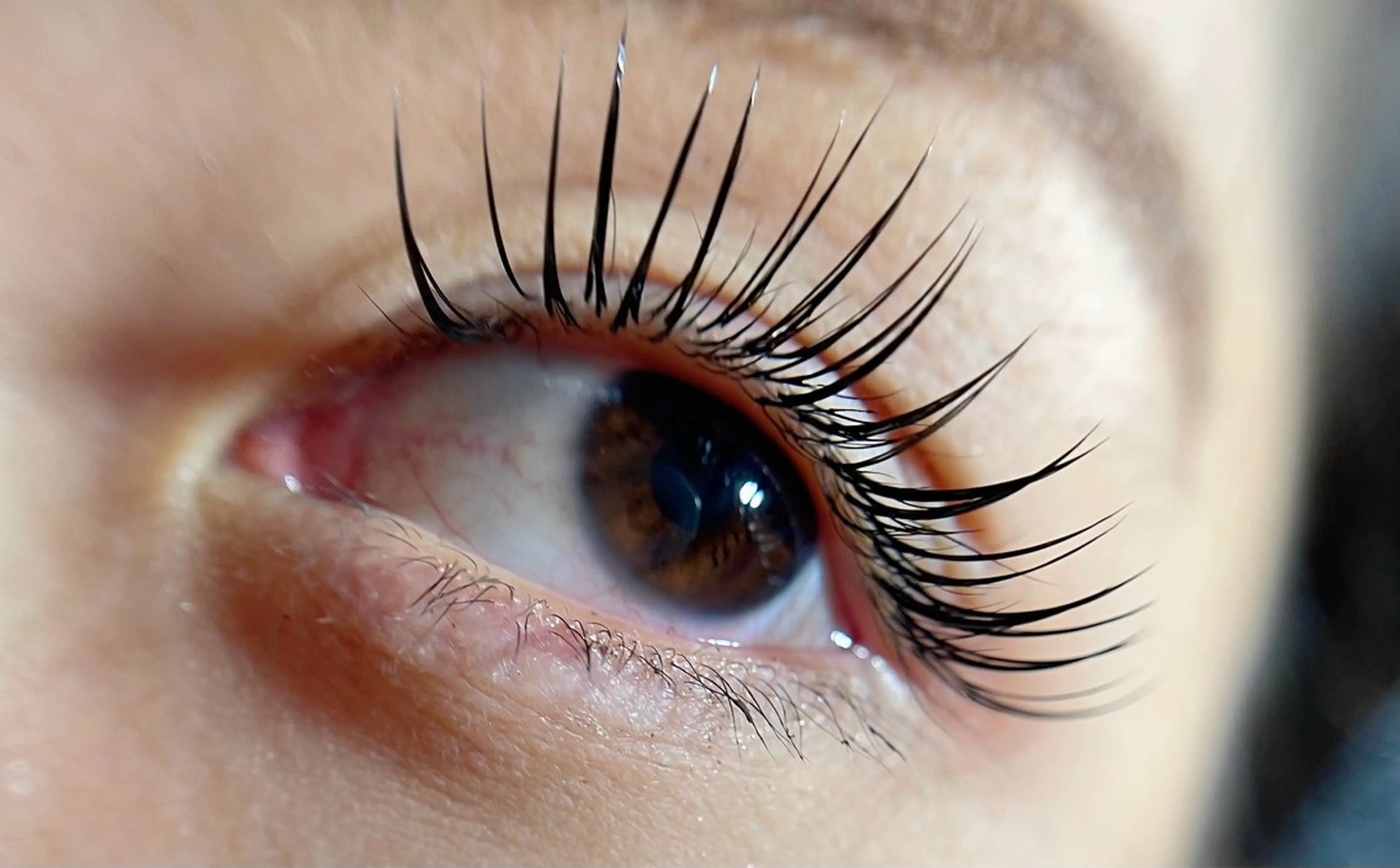 バインドロック100束の写真