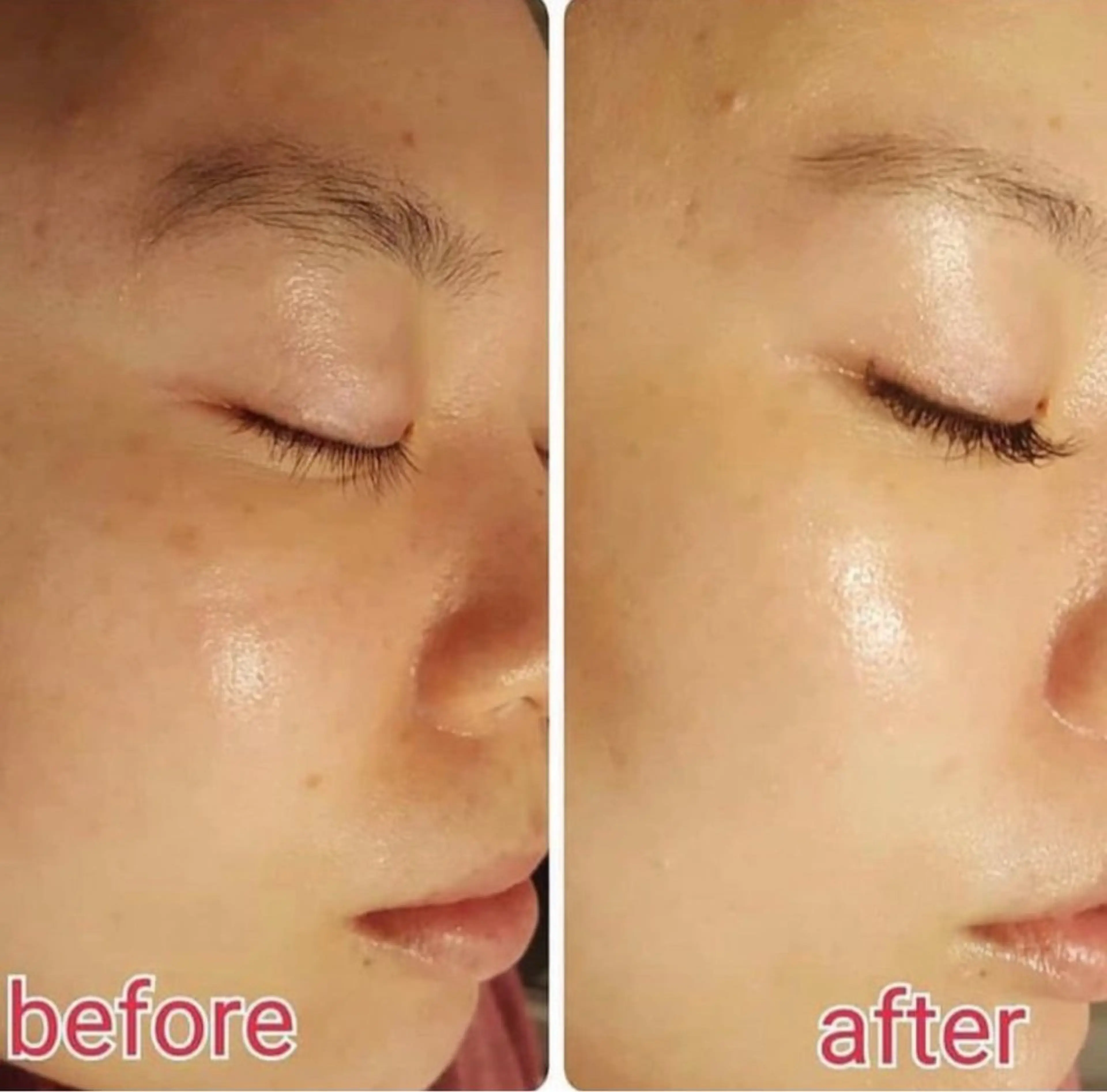 エステ Meow！～トラブル肌専門ピーリング＆脱毛サロン～所属・トラブル肌改善🏥 Meow！🫧🫧のその他イメージ