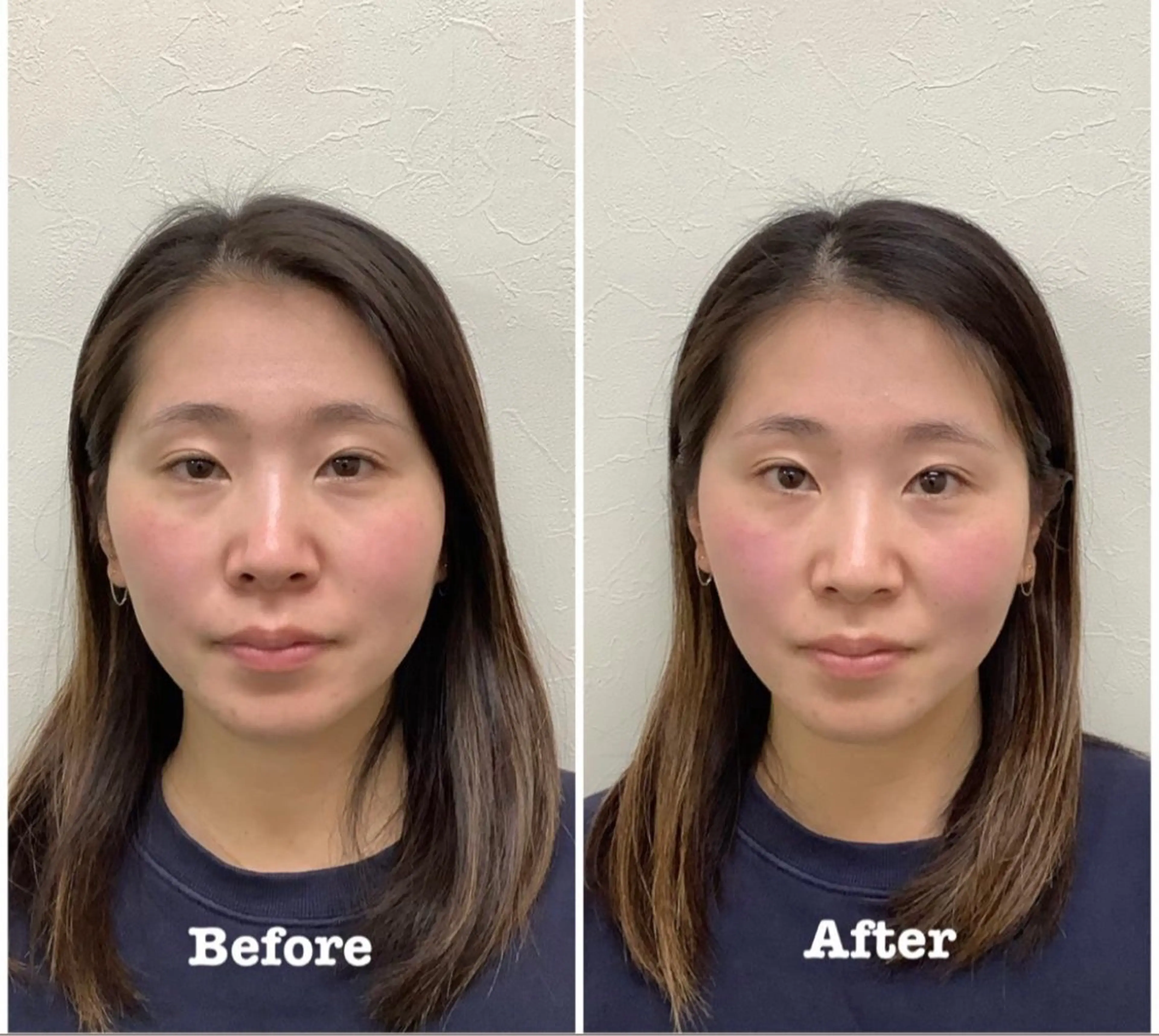 エステ リラク だいち鍼灸院 東加古川院所属・だいち鍼灸院 東加古川院のエステ・リラクイメージ