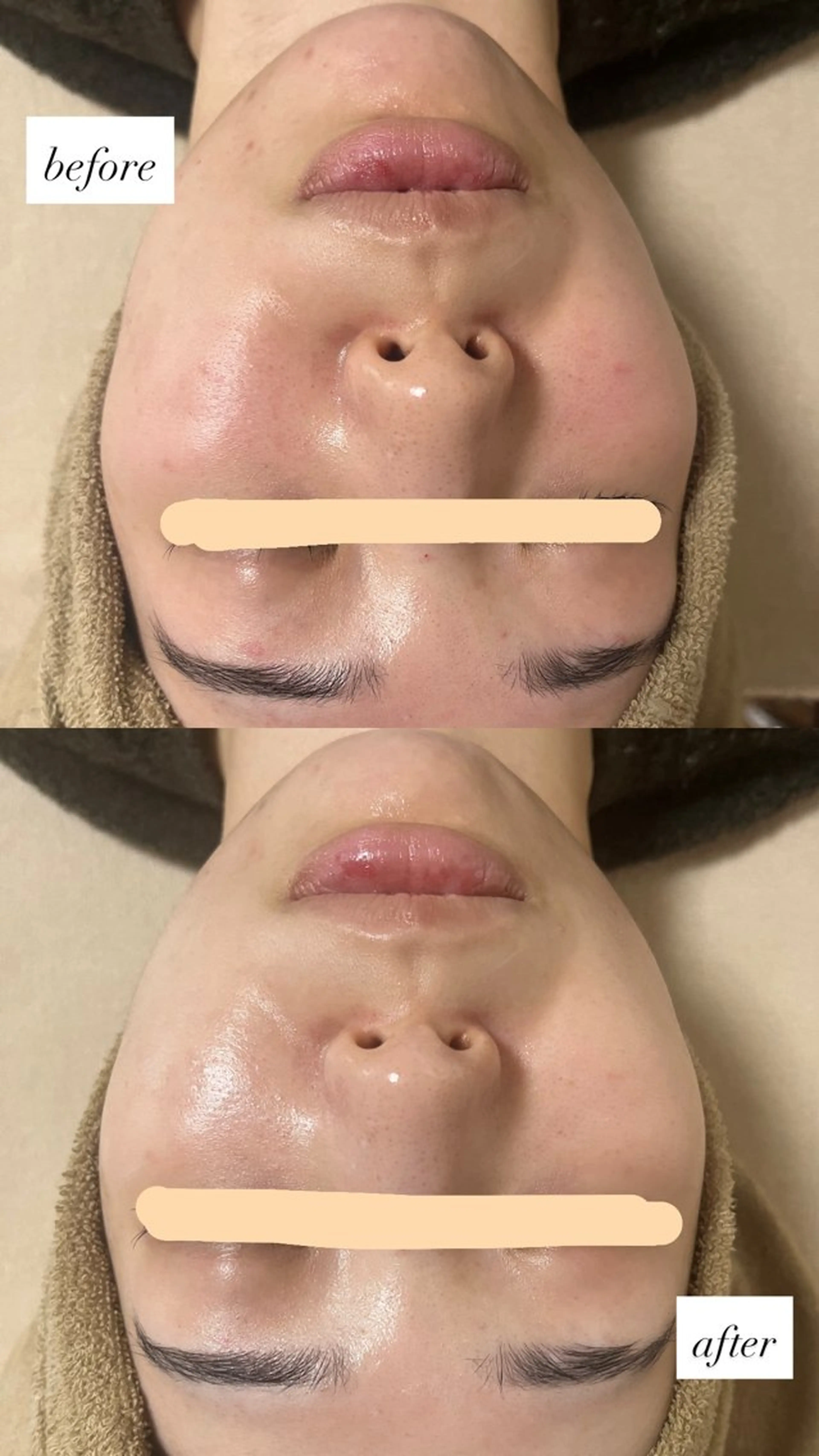 エステ salon More所属・出口 玲菜のエステ・リラクイメージ