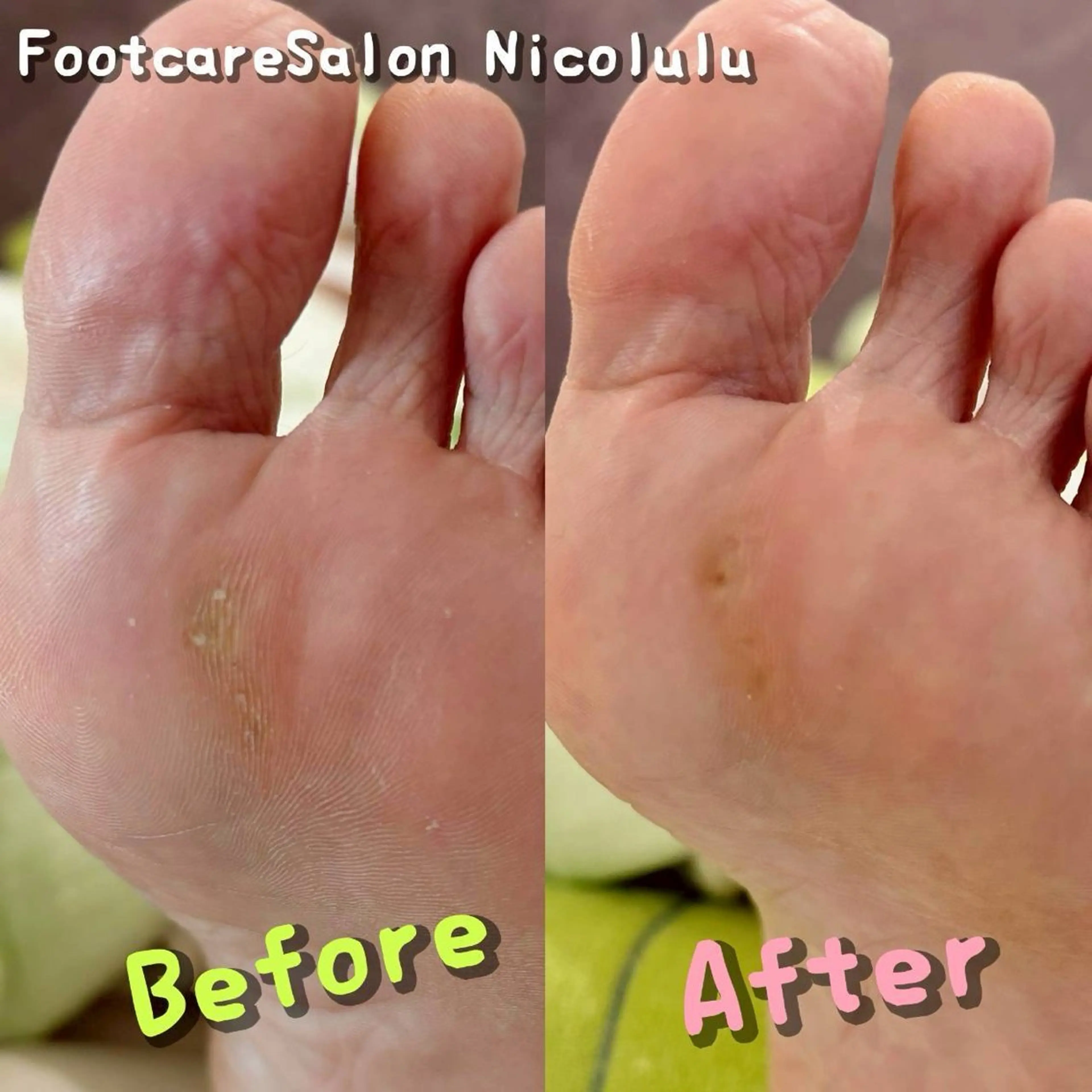 メンズ リラク 足トラブル専門 ニコルル金沢のエステ・リラクイメージ