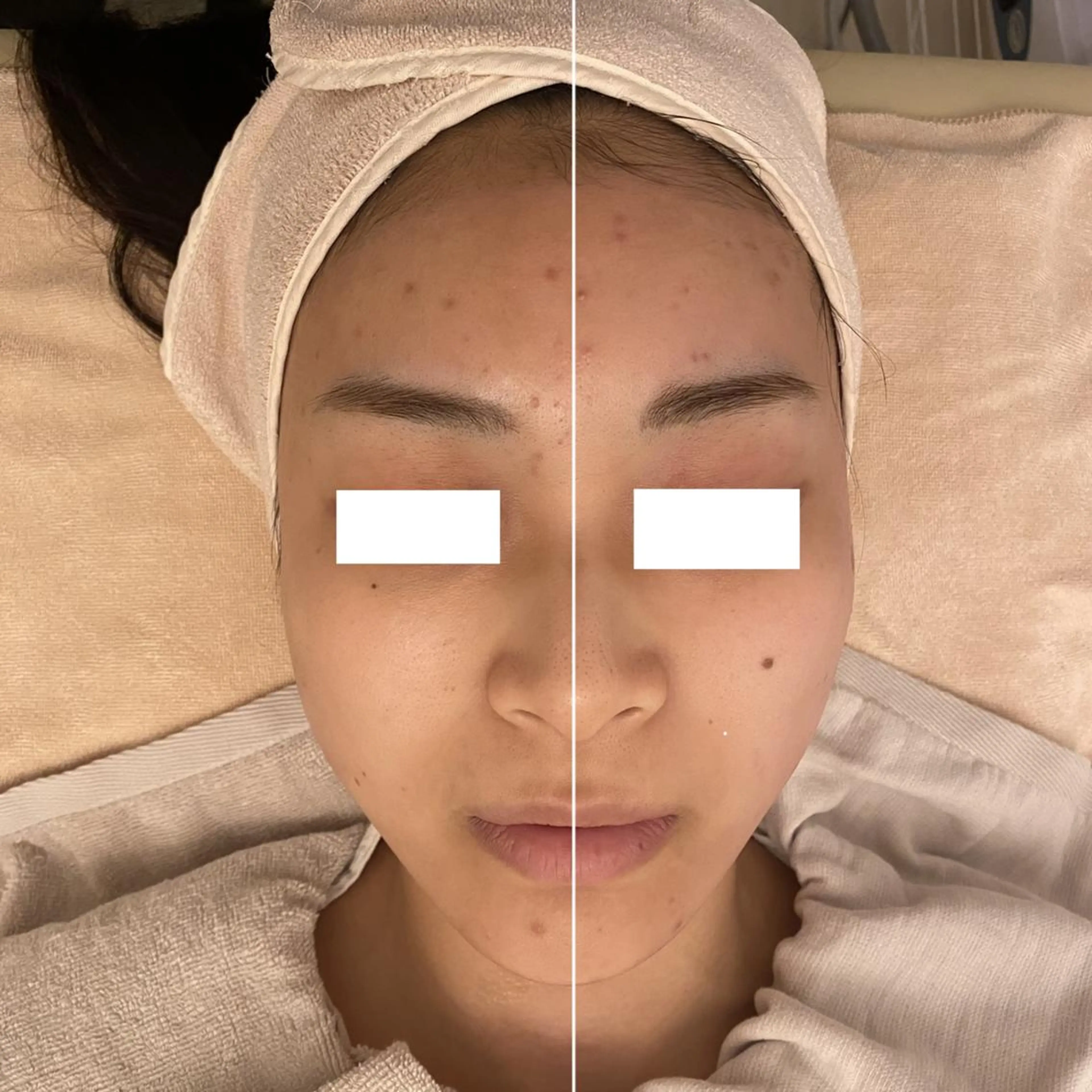 ✨美肌水光✨ アトリエリュバンのエステ・リラクイメージ