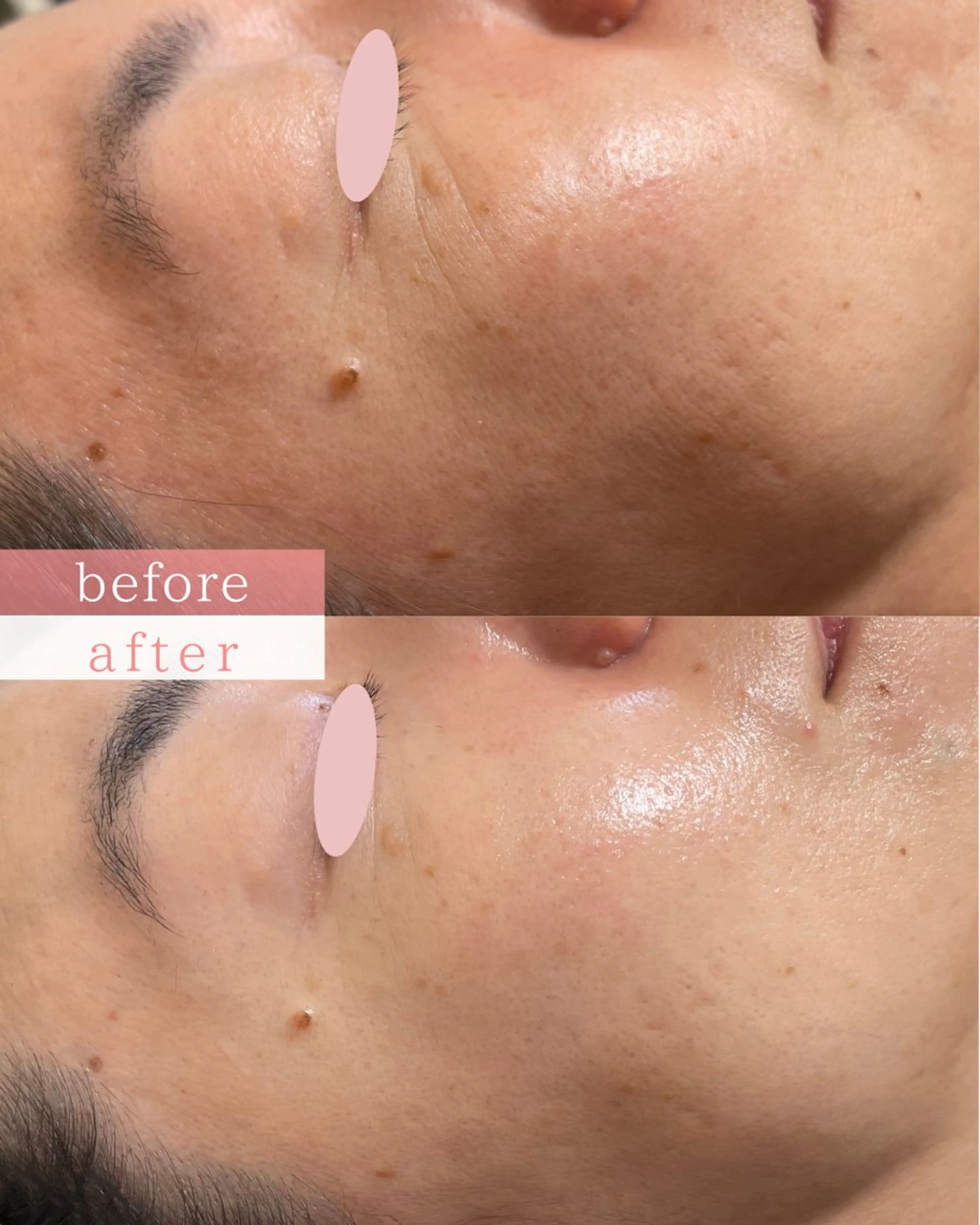 肌質改善サロン LesFleursのエステ・リラクイメージ