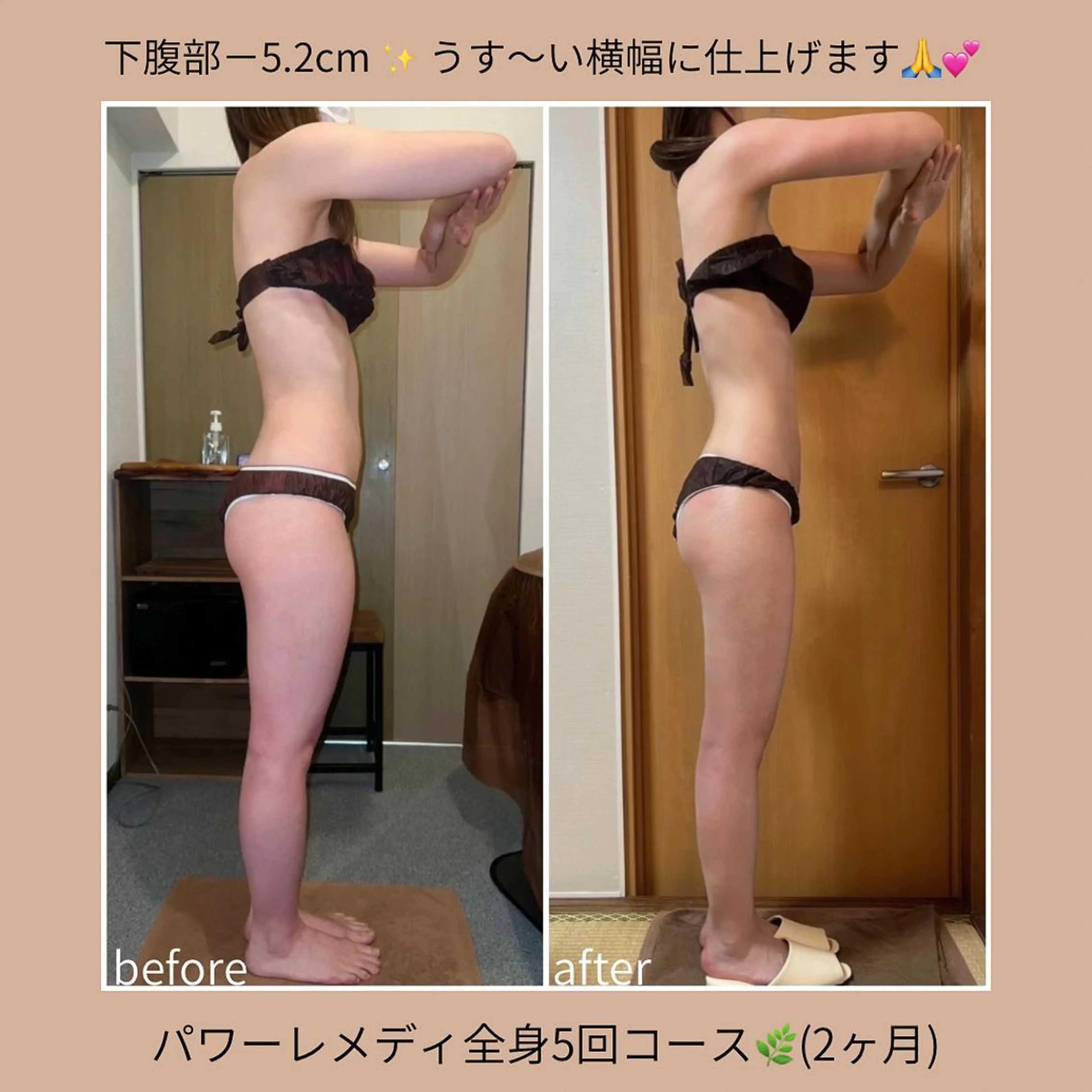 biloop所属・《本気痩せ×疲労改善 》 BILOOPのエステ・リラクイメージ