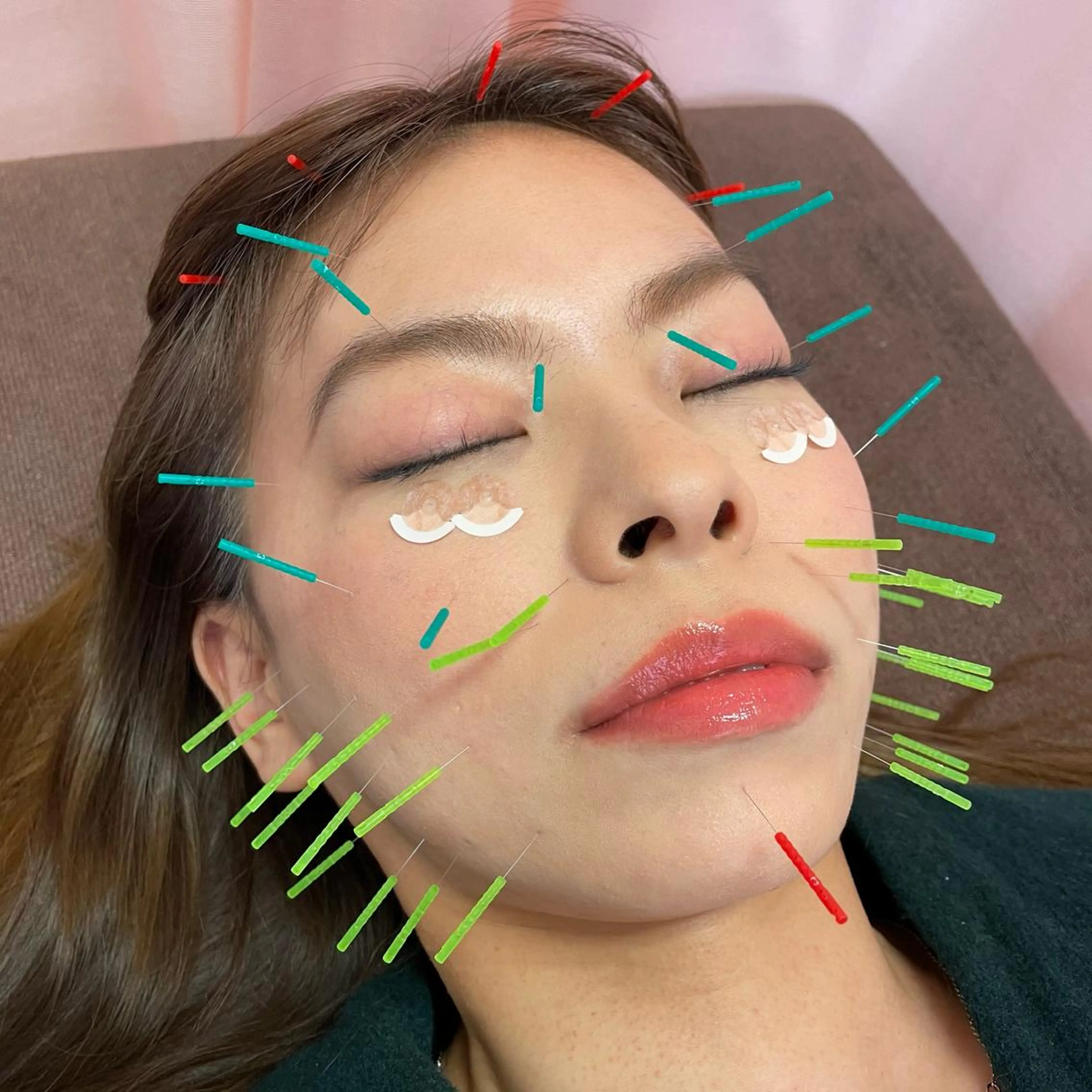 同心整骨院 美容鍼・整体・小顔のエステ・リラクイメージ