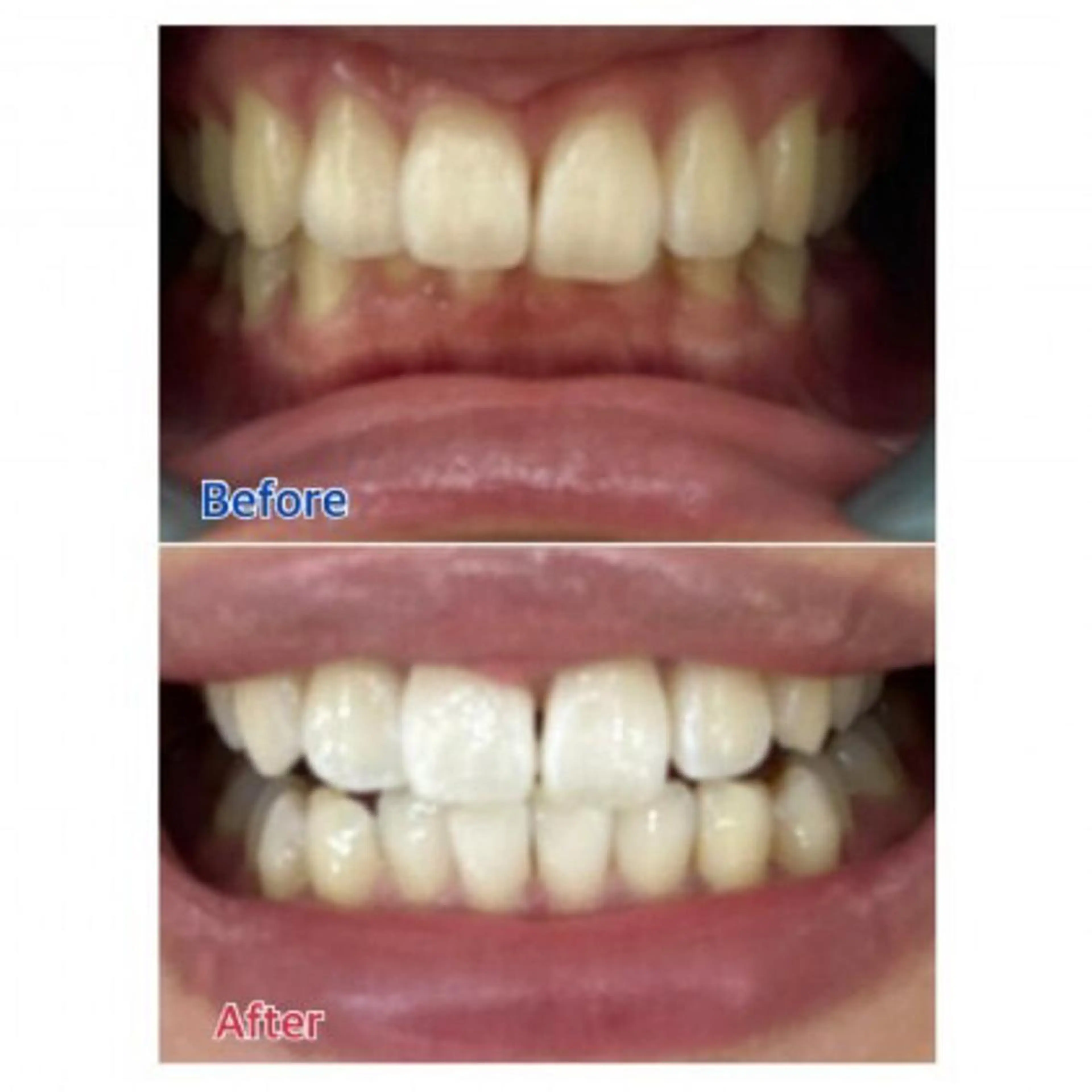 M渋谷店所属・Ｍ渋谷 ホワイトニングのエステ・リラクイメージ