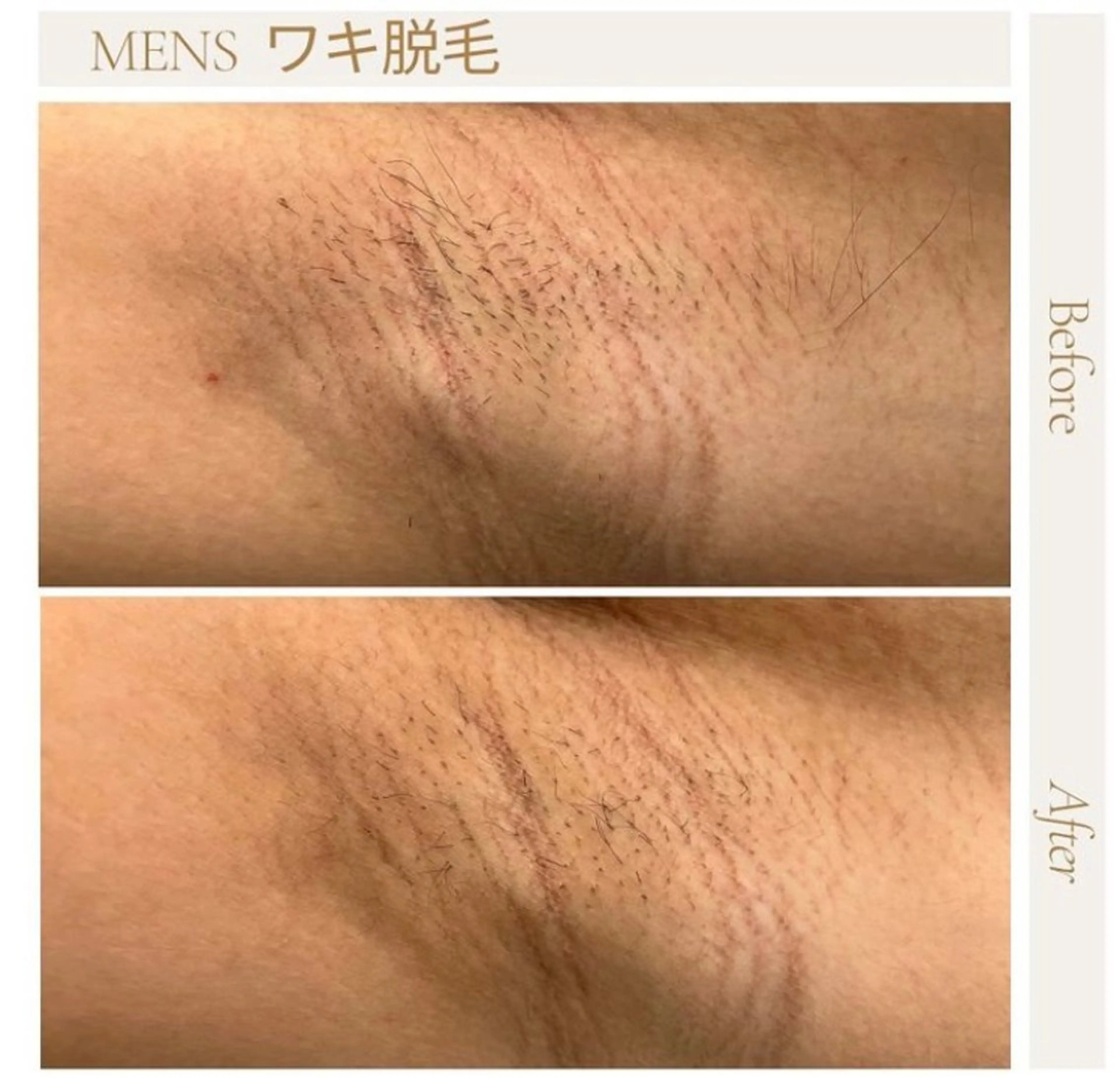 メンズ 脱毛＆フェイシャル/ Rappore;増田のエステ・リラクイメージ