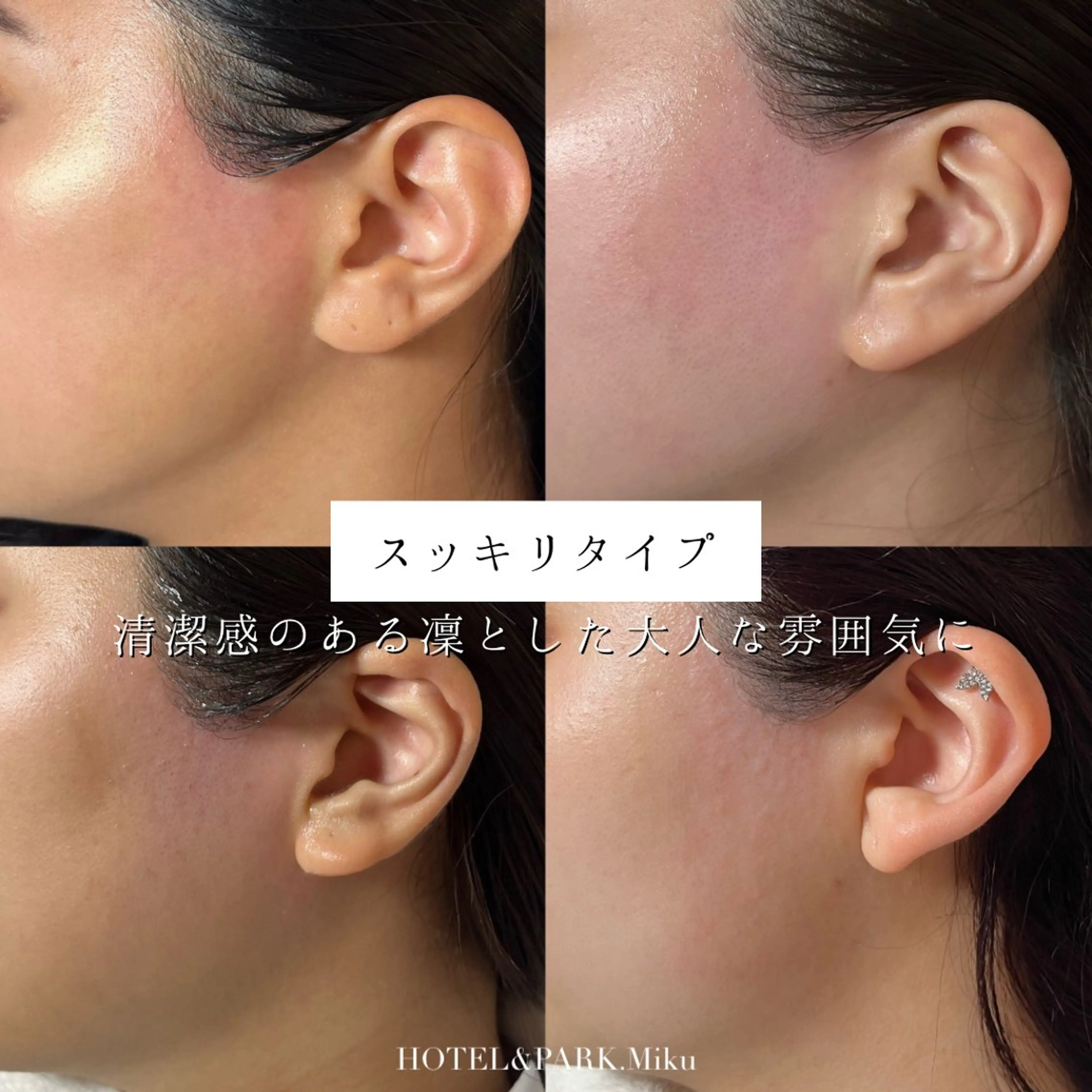 脱毛 HOTEL&PARK Mikuワックス脱毛のエステ・リラクイメージ