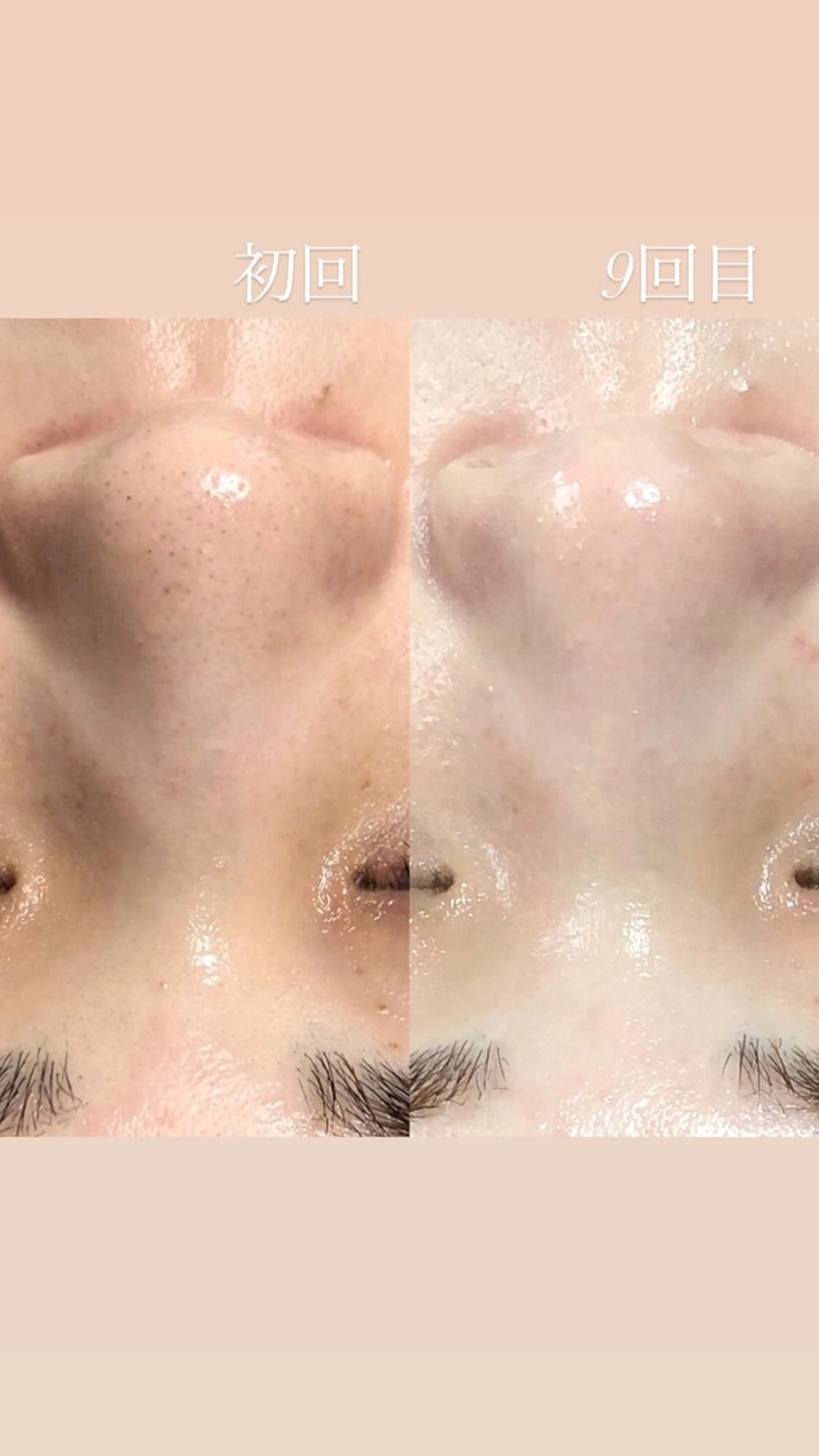 🆕✨　𝑬𝑹𝑰 南大塚の美肌改善のエステ・リラクイメージ