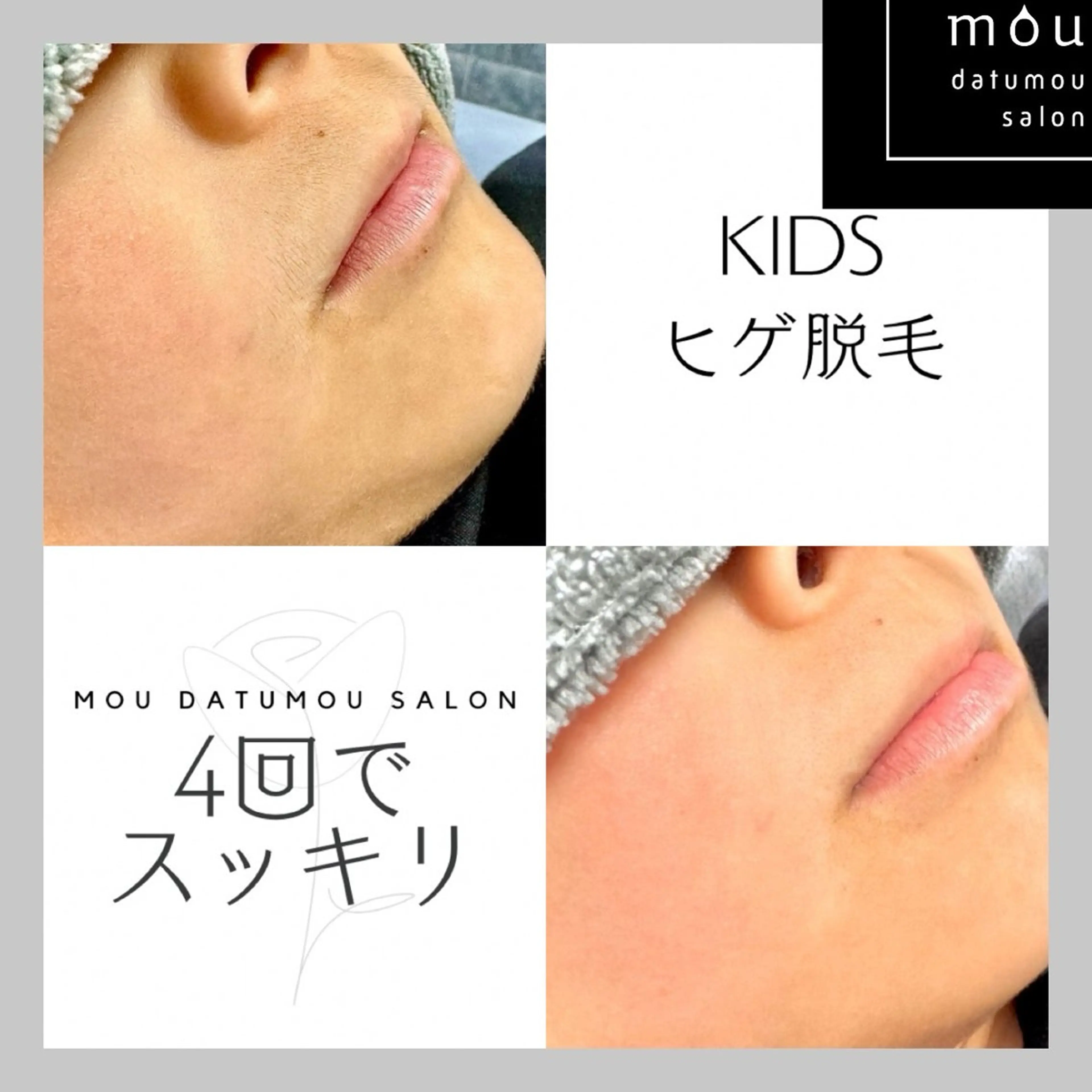 キッズ 脱毛 moudatumou salonのエステ・リラクイメージ