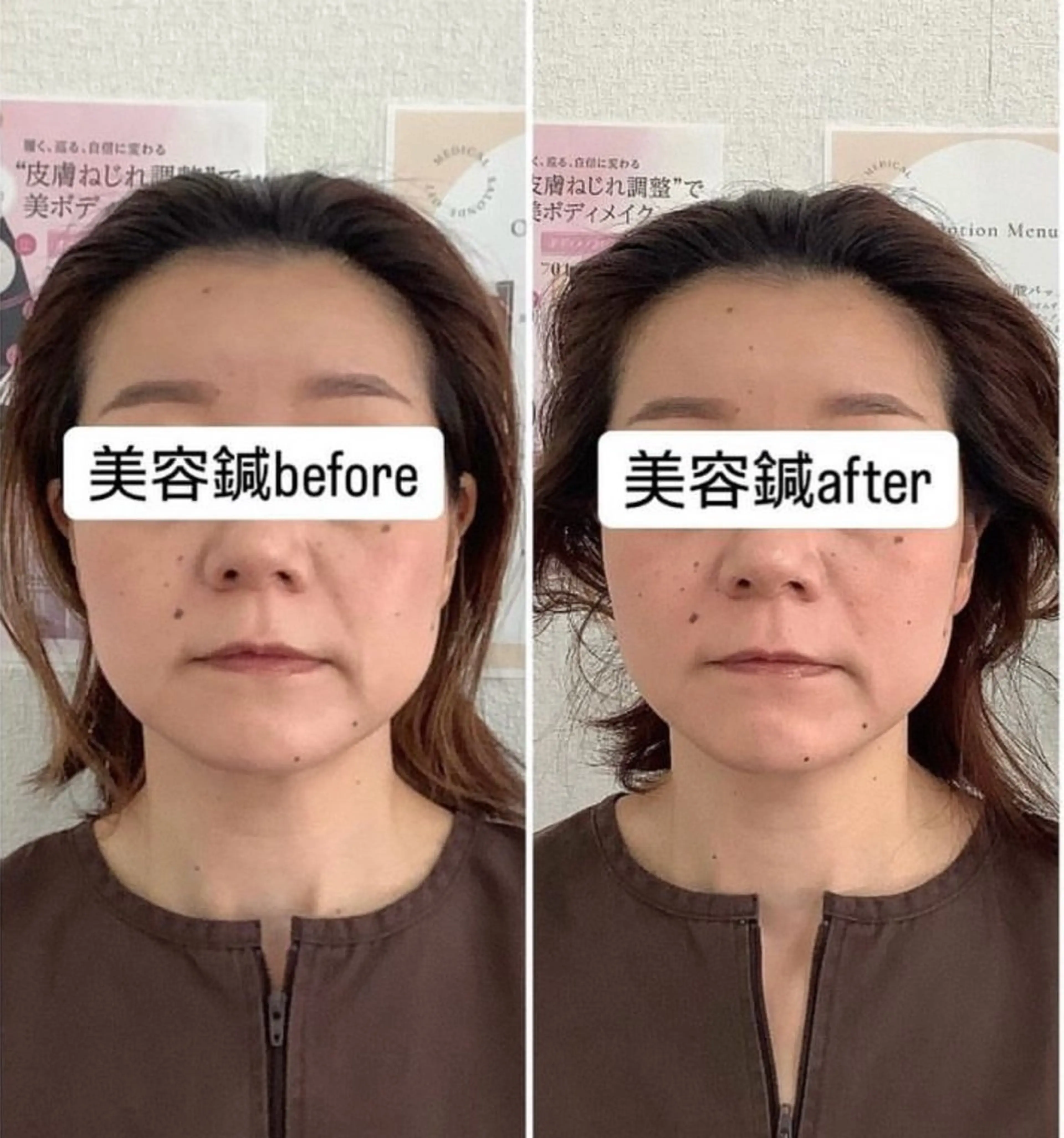 エステ リラク hari salon de off　美容鍼灸×小顔整体【ハリサロンドオフ】所属・美容鍼灸×小顔整体♡ ハリサロンドオフ堺東のエステ・リラクイメージ