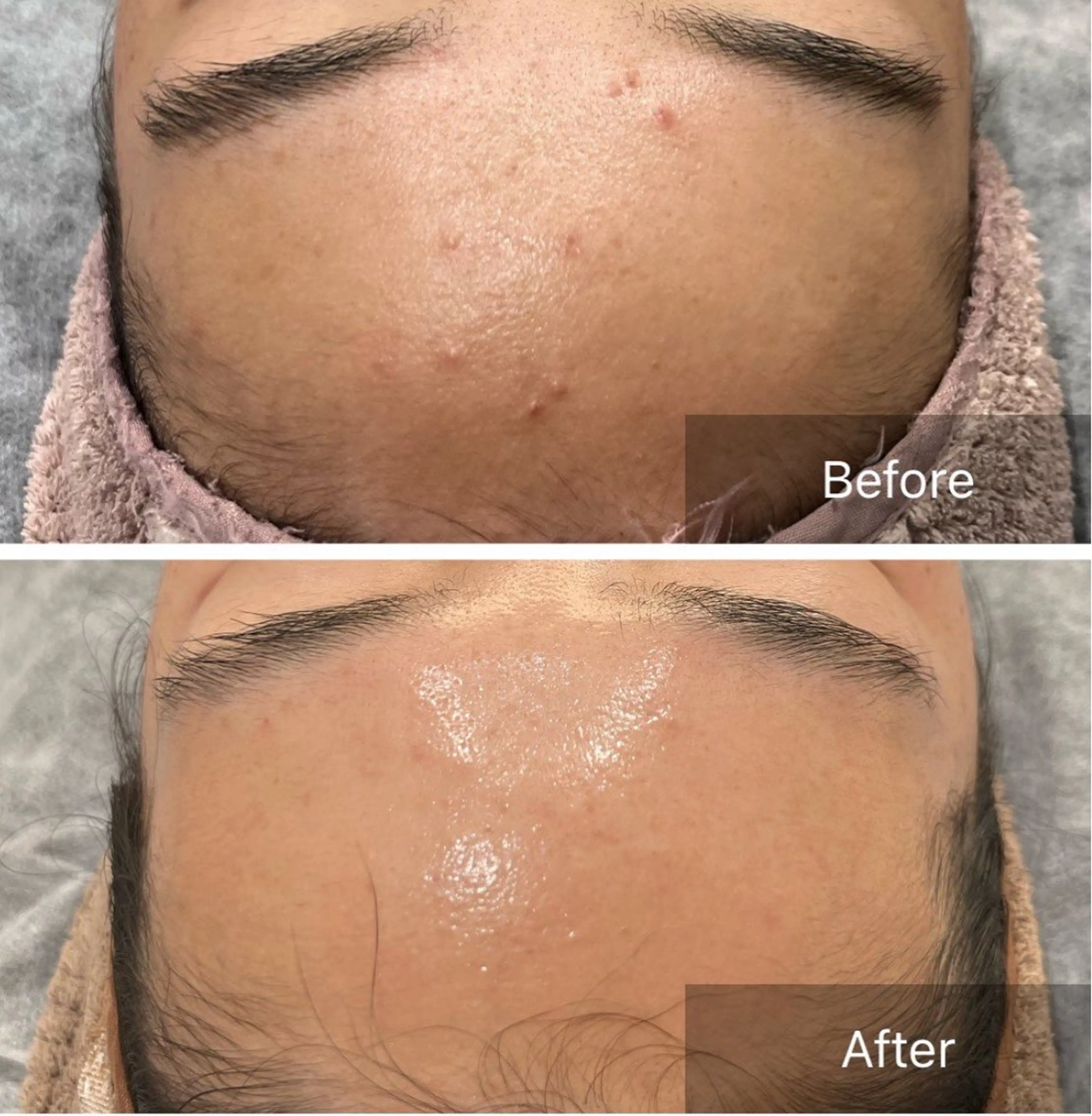 Ummi所属・肌管理／眉毛．まつ毛 陽子の眉毛・アイブロウイメージ