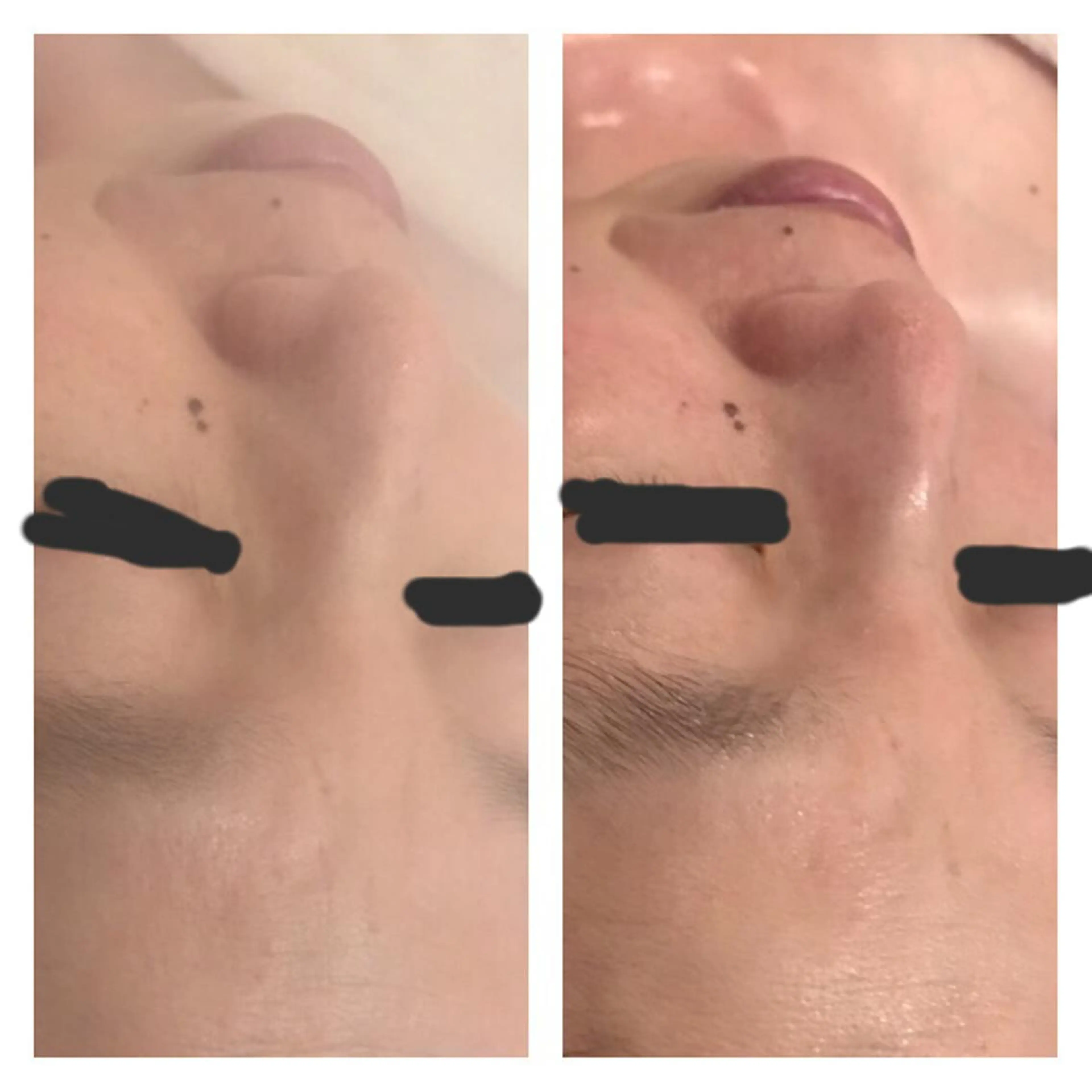 ネイル フェアリーローズ所属・fairyrose organicエステのエステ・リラクイメージ