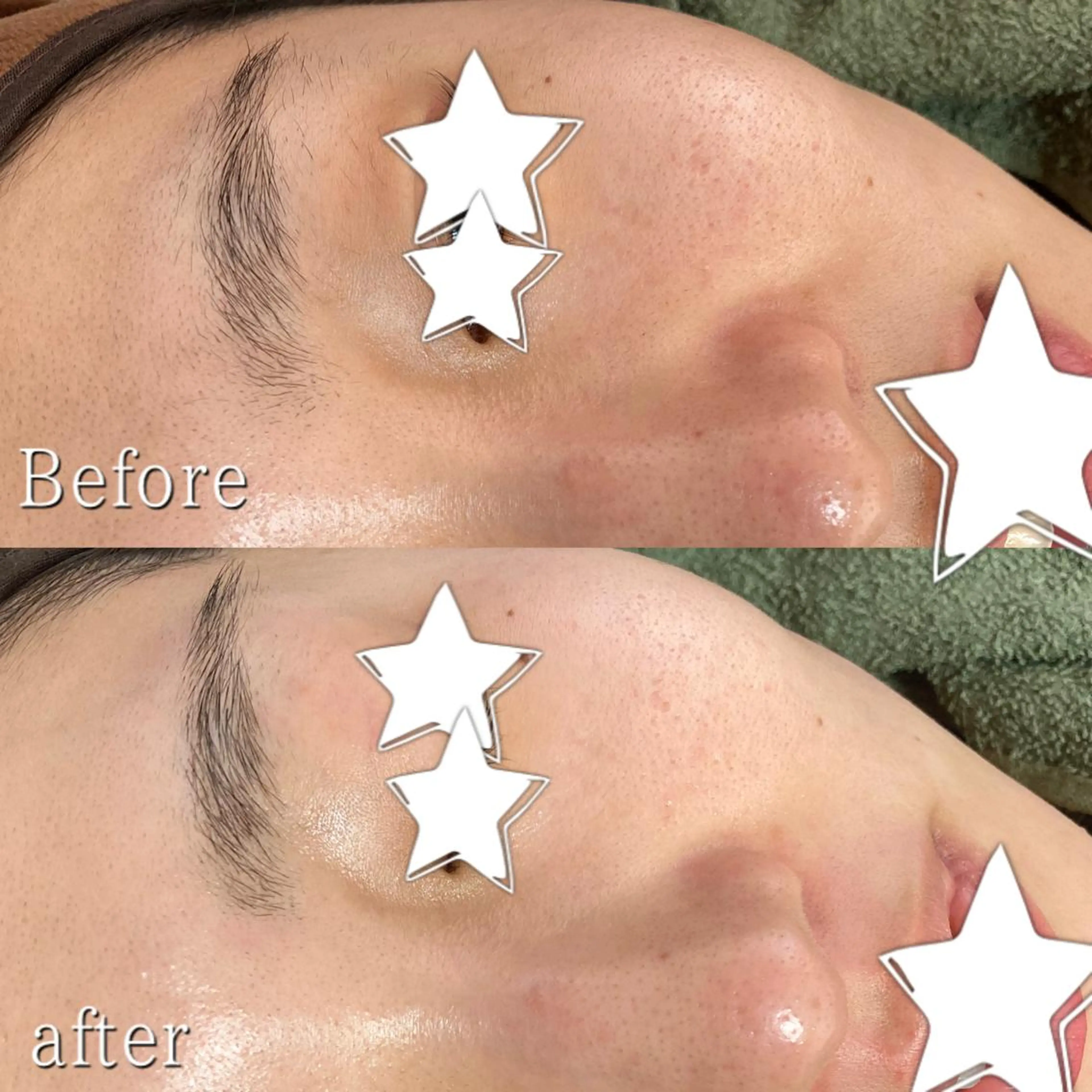 脱毛サロン KiWiのエステ・リラクイメージ