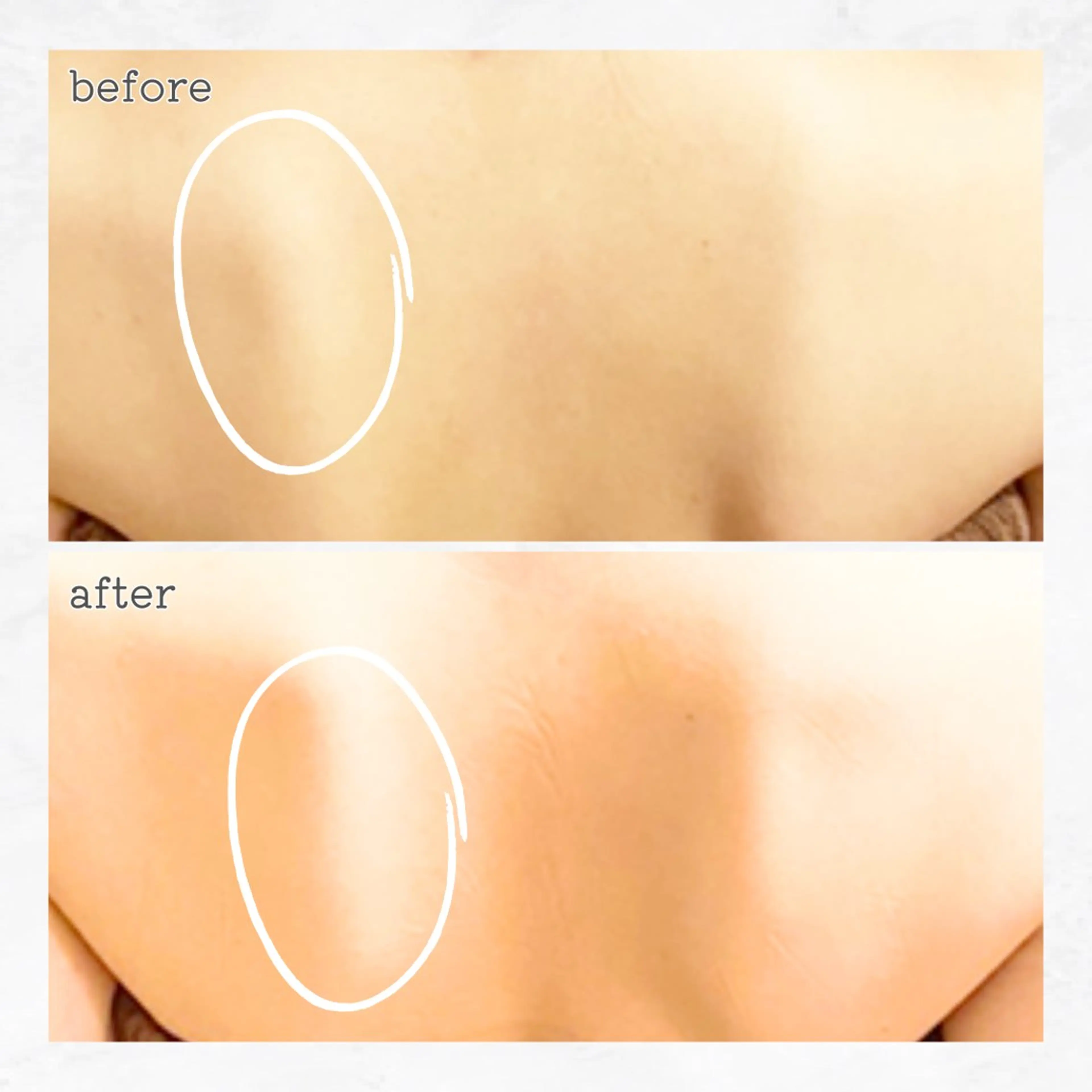 リラク 眉とお肌の専門サロン RioL / Aiのエステ・リラクイメージ