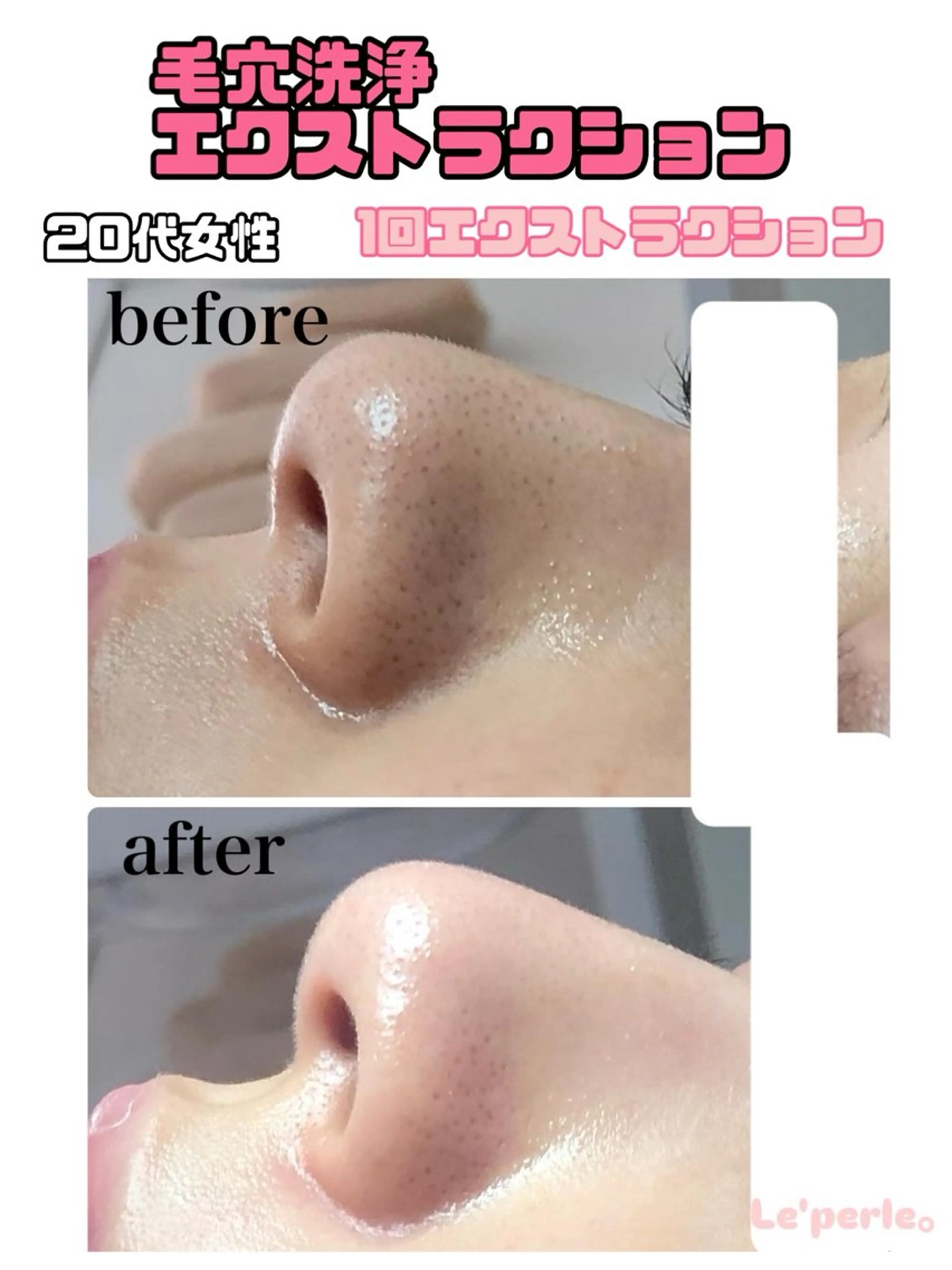 エステ Le'perle｡所属・Le'perle｡ Kyokaのエステ・リラクイメージ