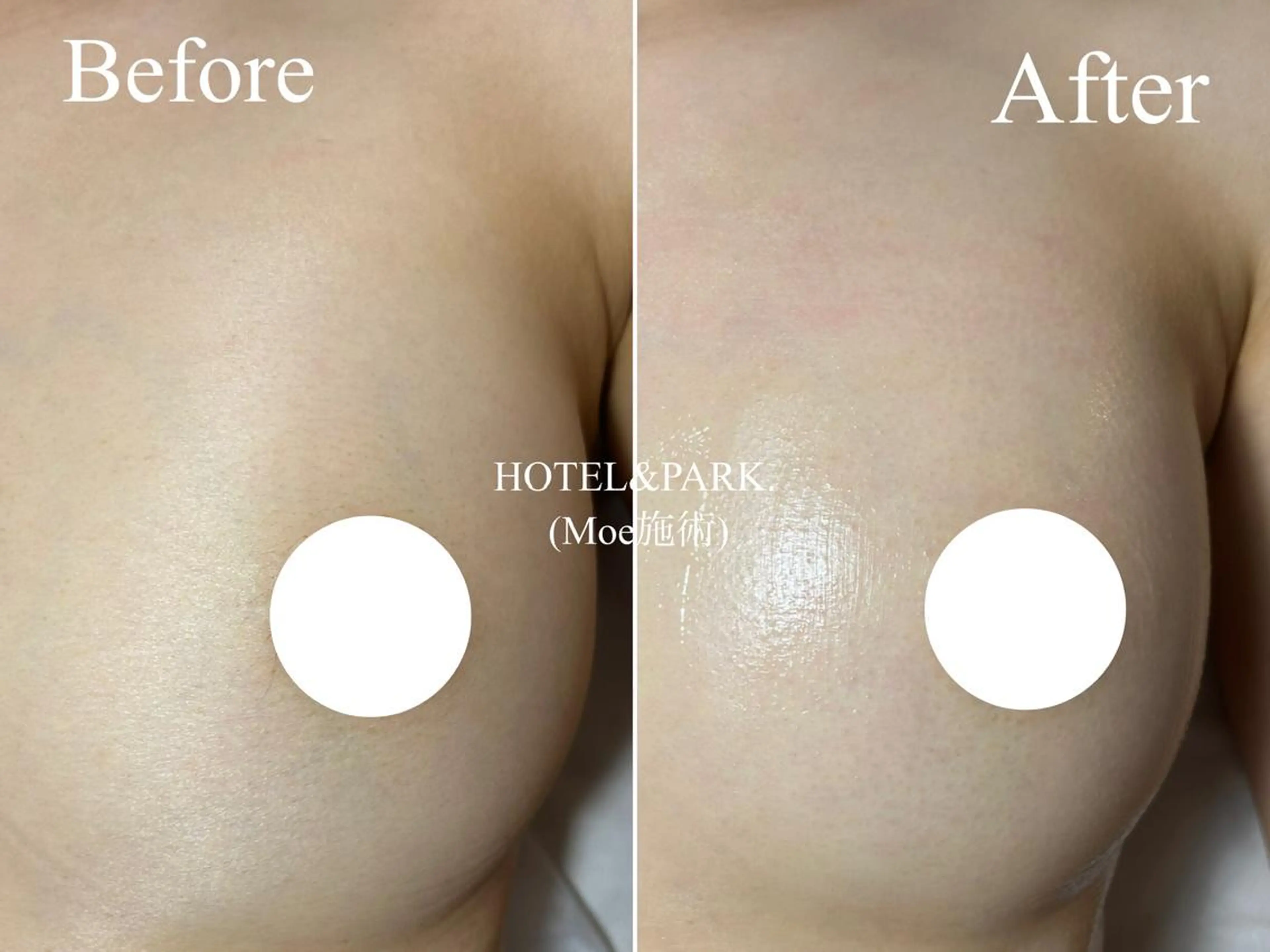 HOTEL&PARK . ワックス脱毛のエステ・リラクイメージ