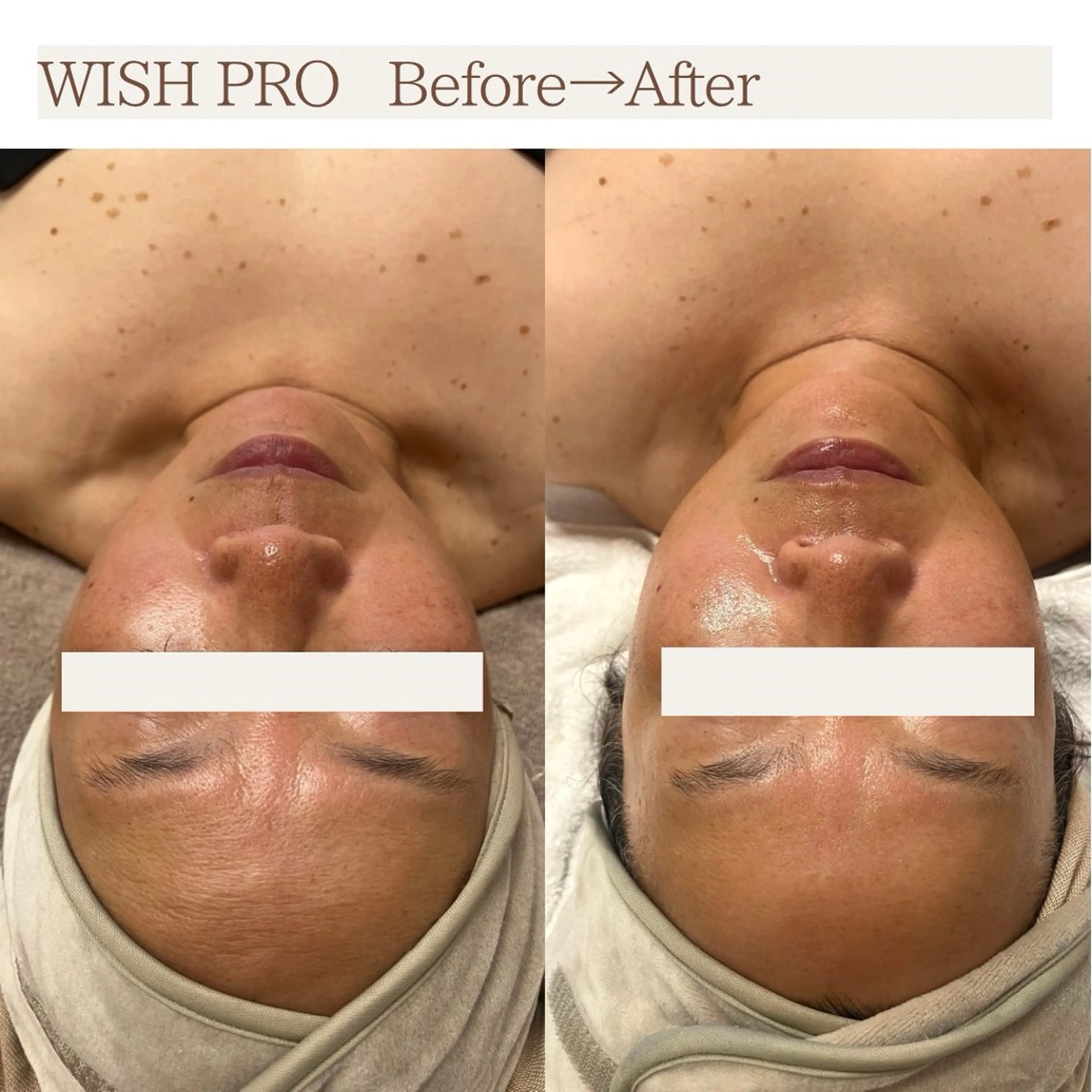 Total Beauty salon Bloom所属・肌育WISHpro 専門サロンBloomのエステ・リラクイメージ