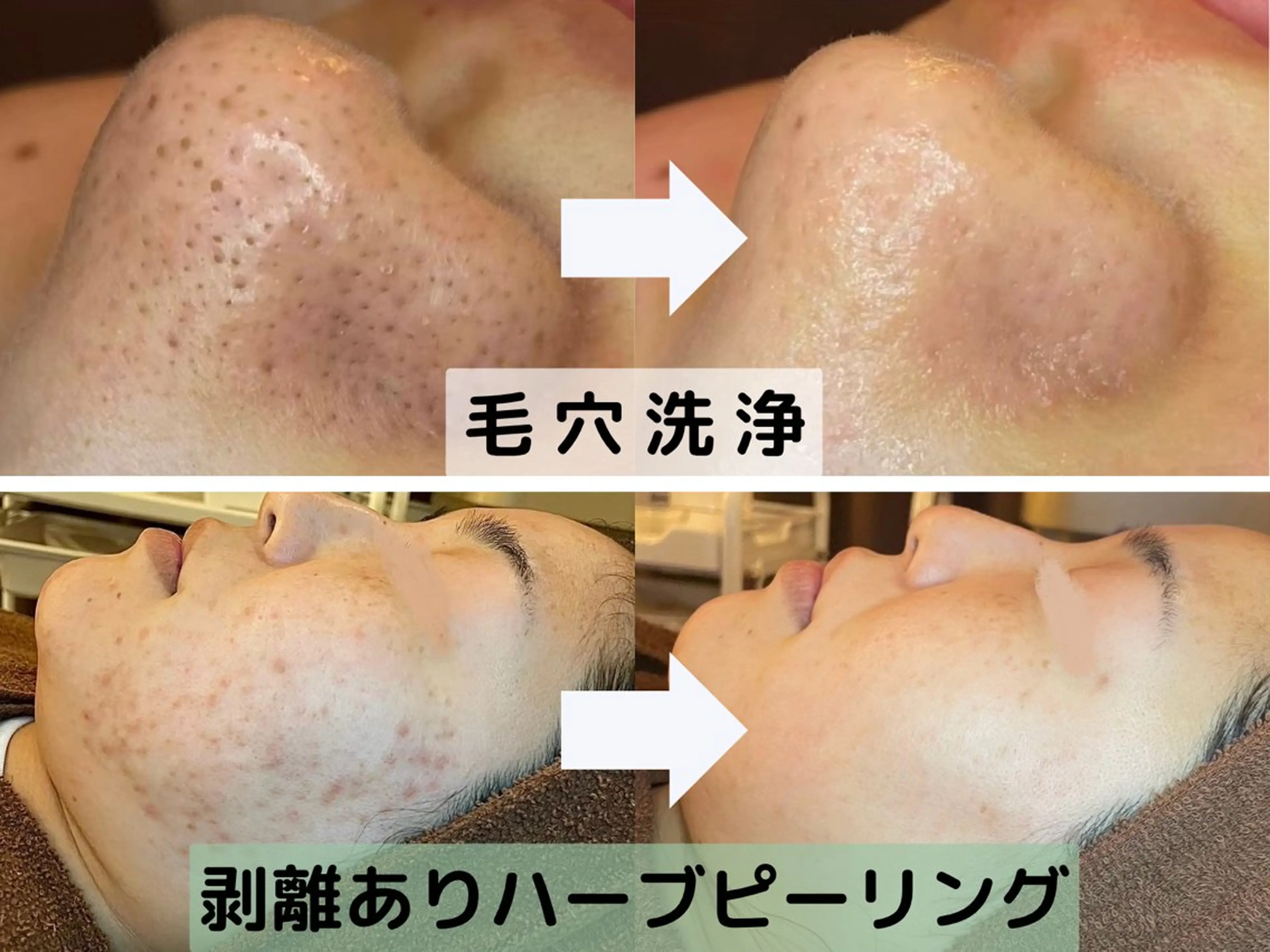 【肌質改善サロン】 医療提携シャルムのエステ・リラクイメージ