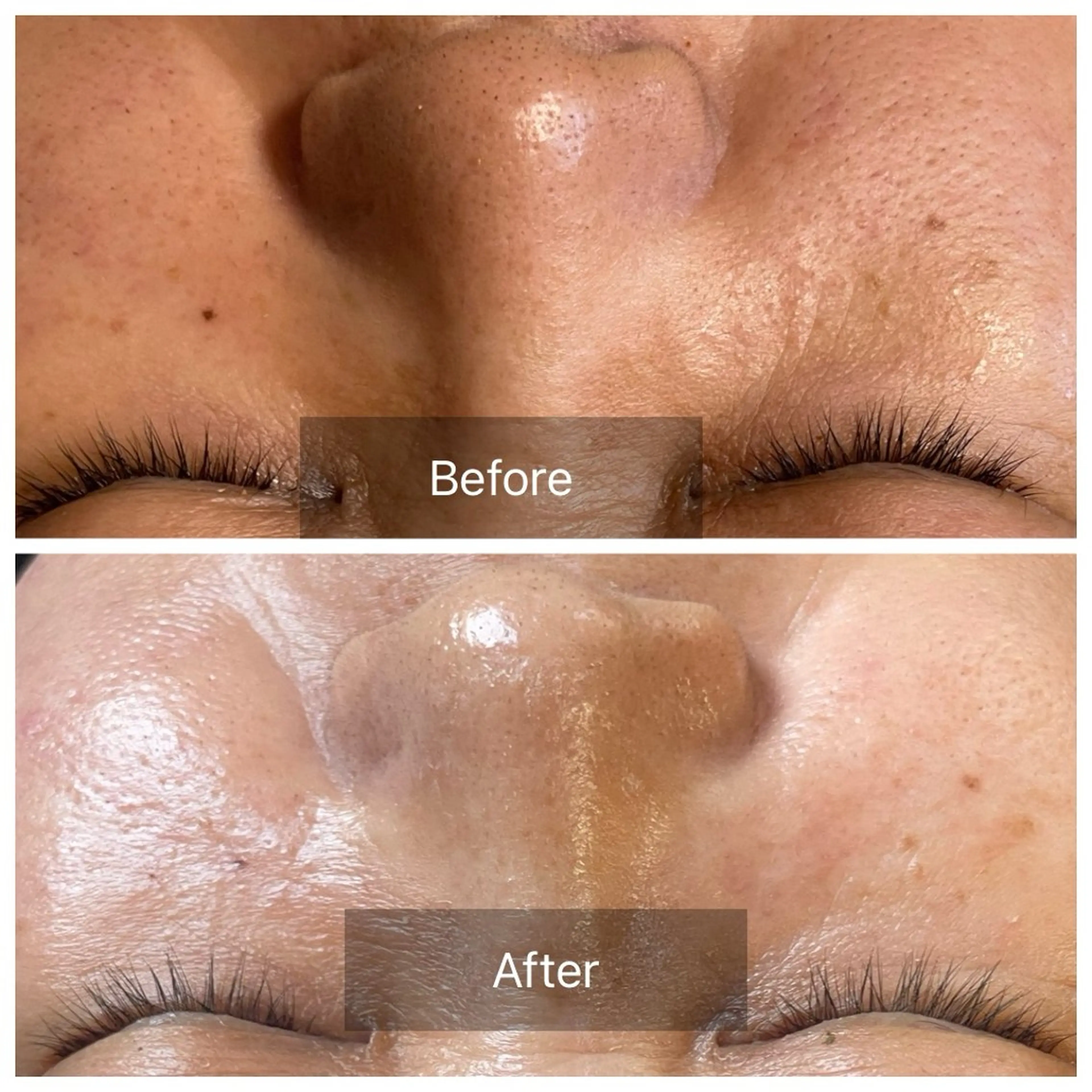 ハーブピーリング Lanaのエステ・リラクイメージ