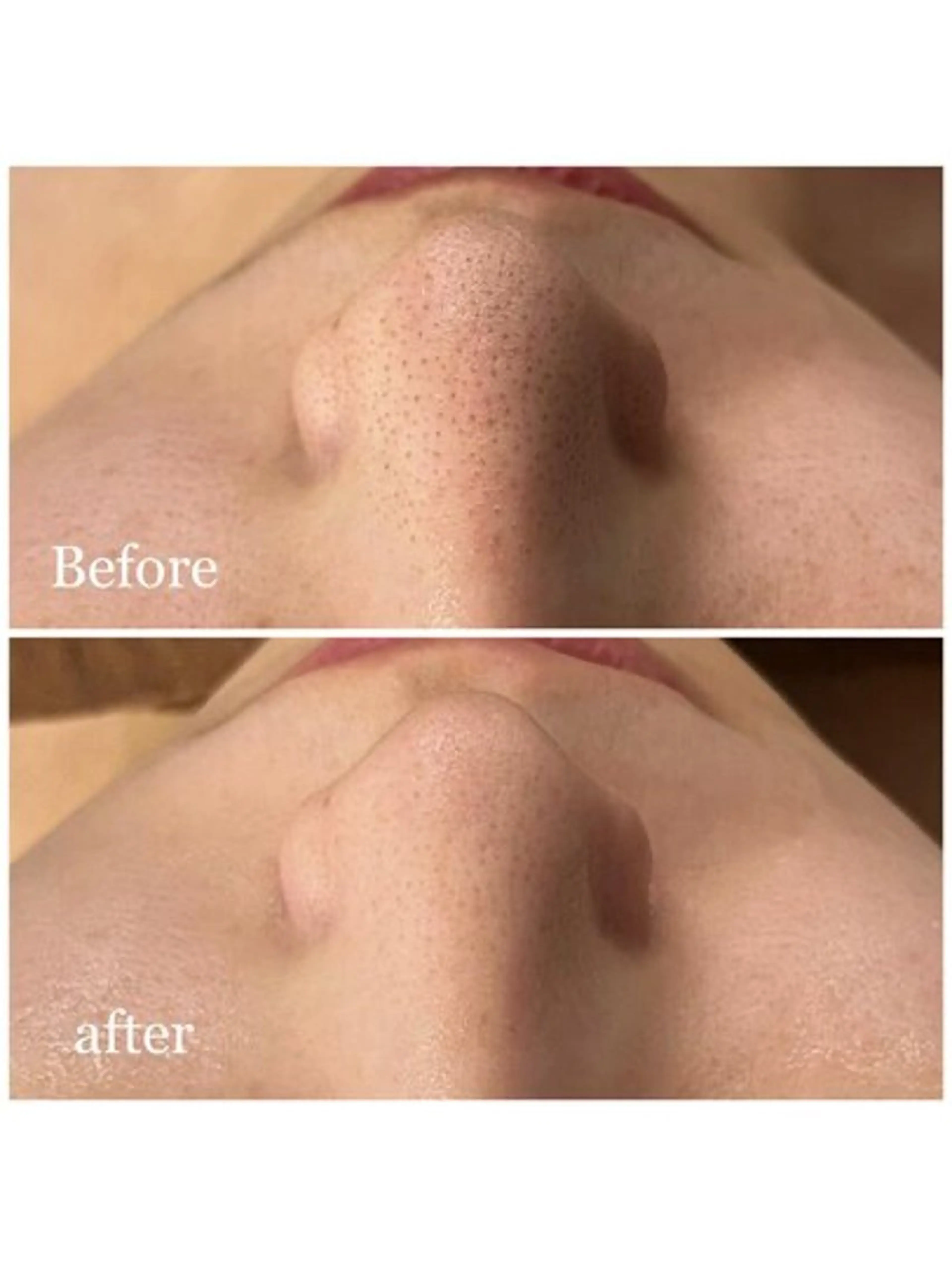 エステ 🌼SALON Lazuli久留米のエステ・リラクイメージ