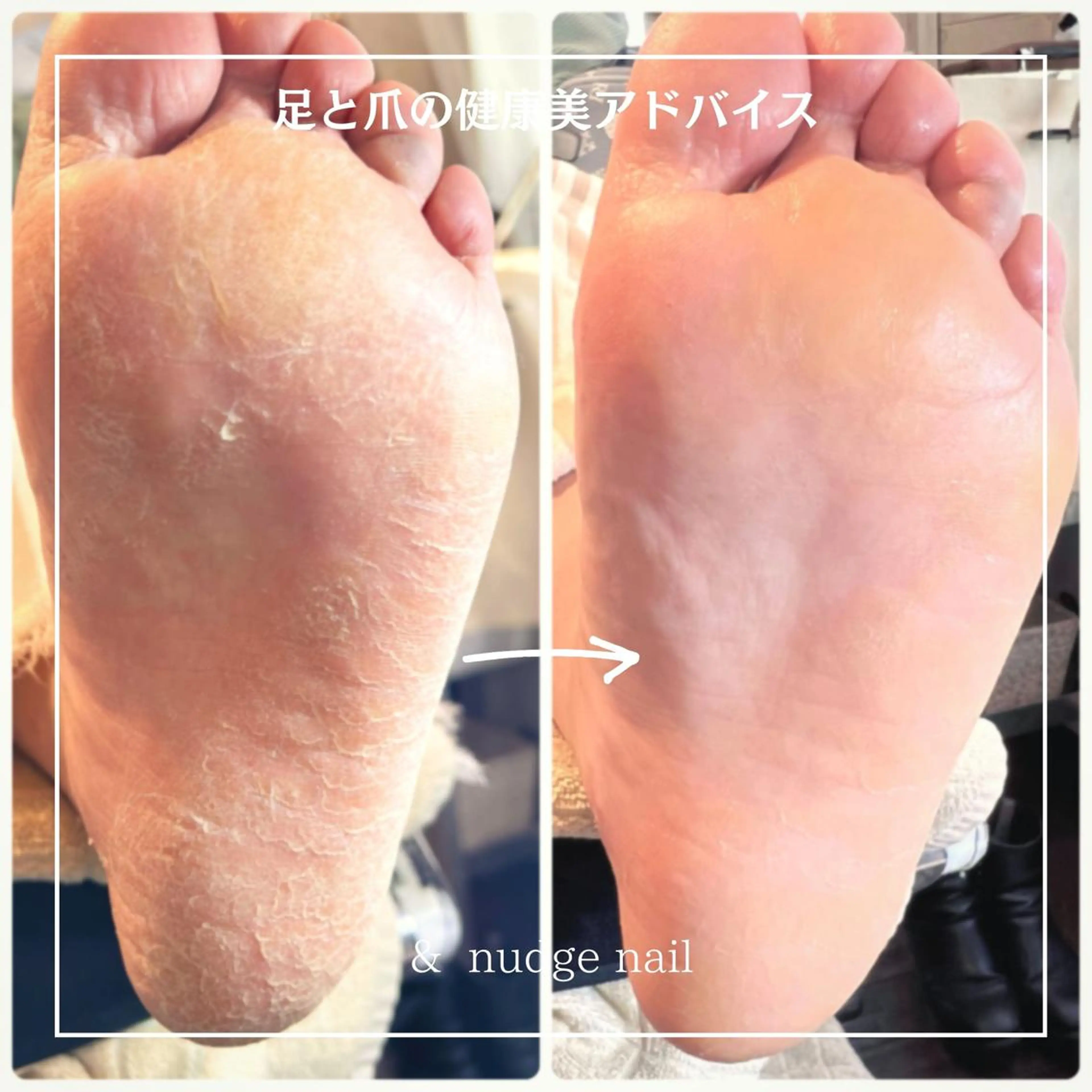 ネイル & nudge nail所属・&nudgenail 本多のネイルデザイン