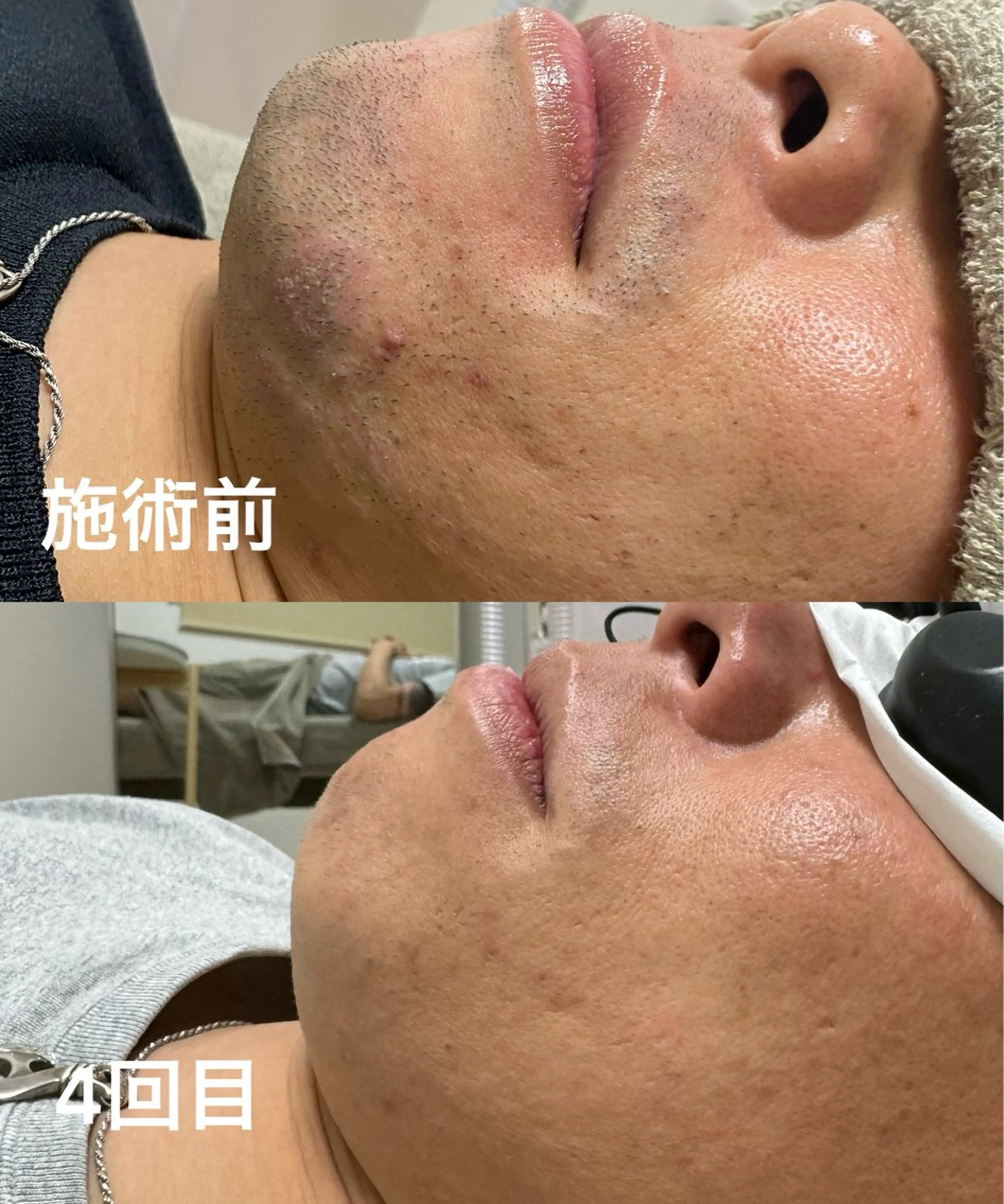 メンズ Akala miのエステ・リラクイメージ