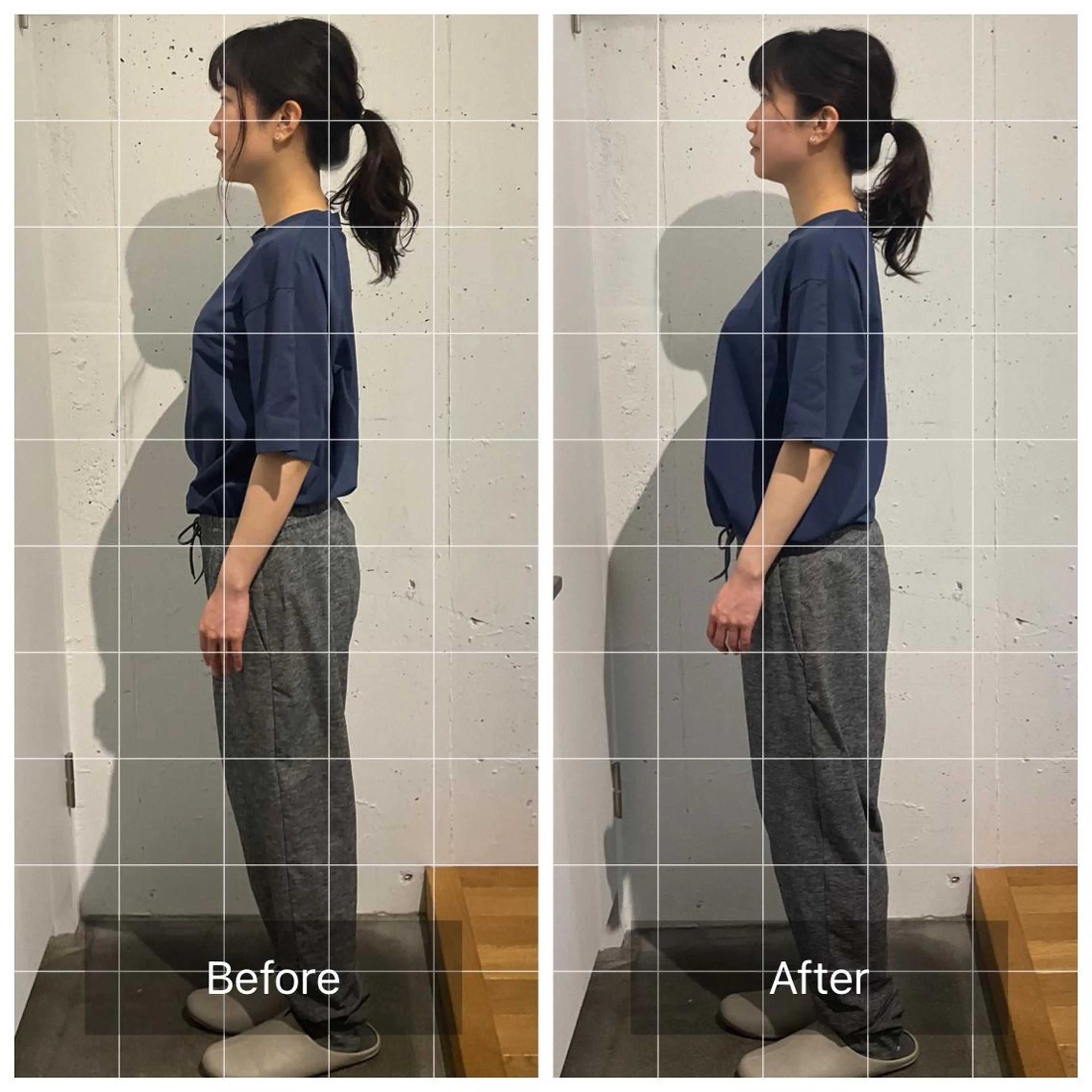 顔のたるみ・左右差/姿勢調整の写真