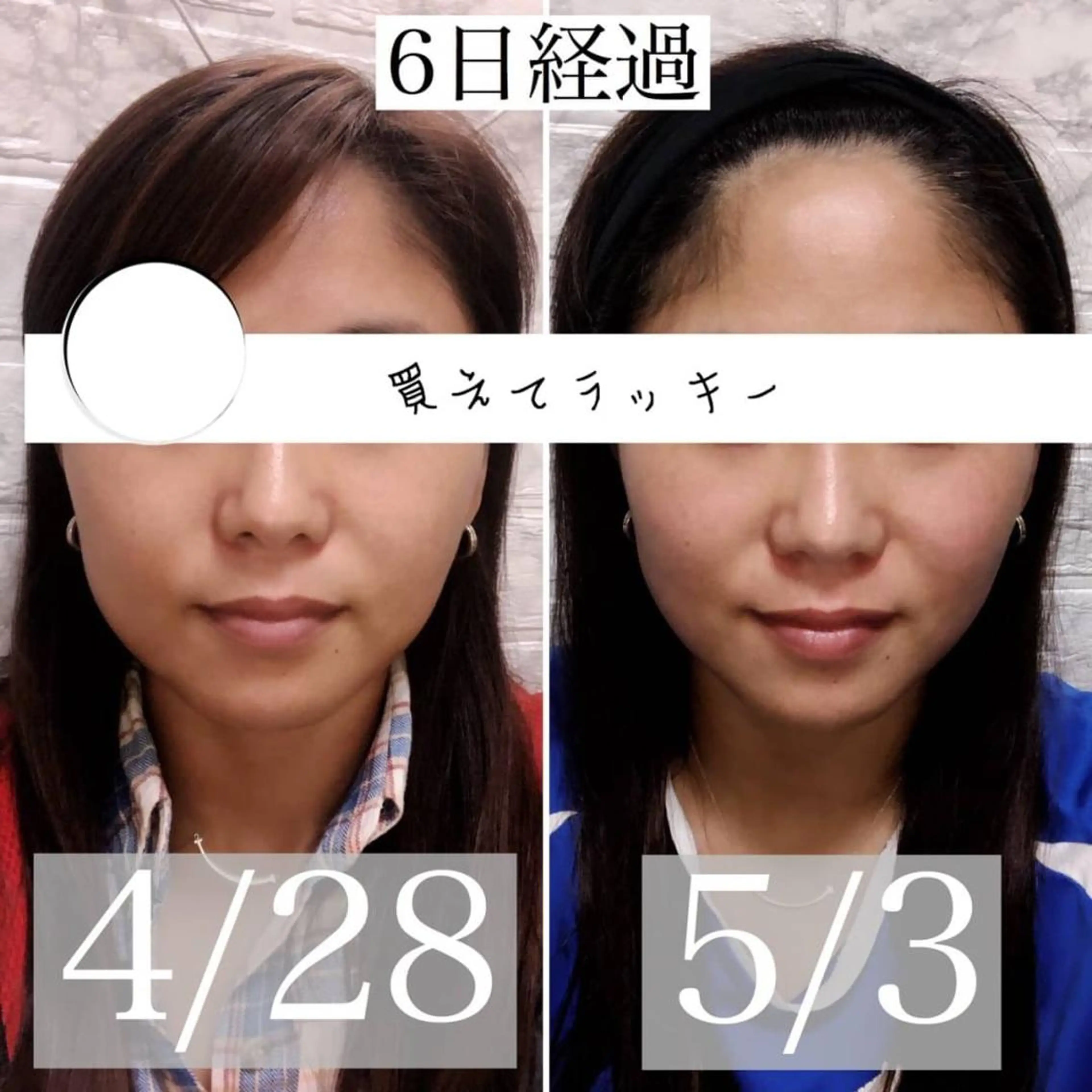 小顔矯正/美容整体 /骨盤矯正✨+Mi2のエステ・リラクイメージ