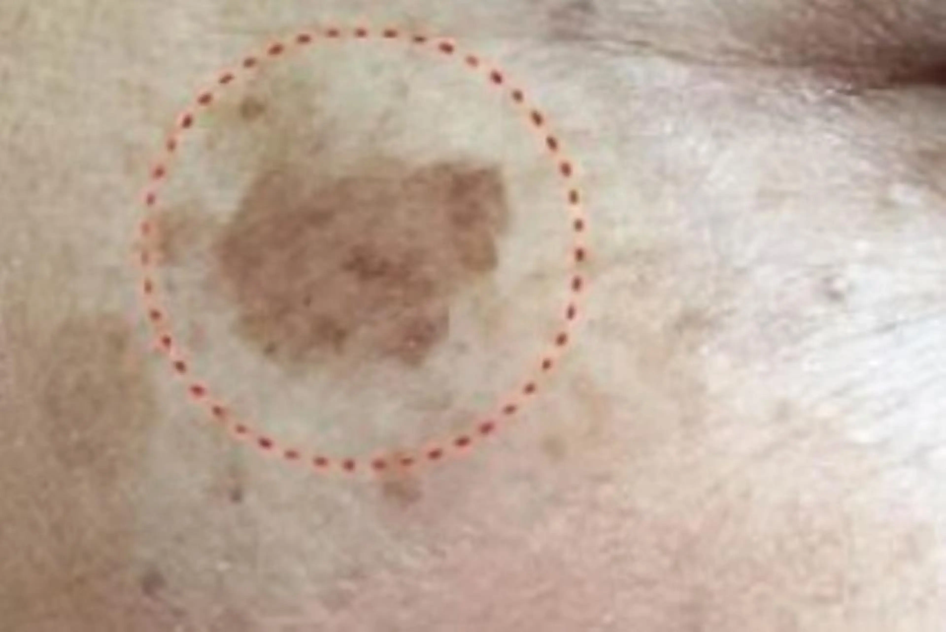 🅖🅤🅩🅔🅛 salonのエステ・リラクイメージ