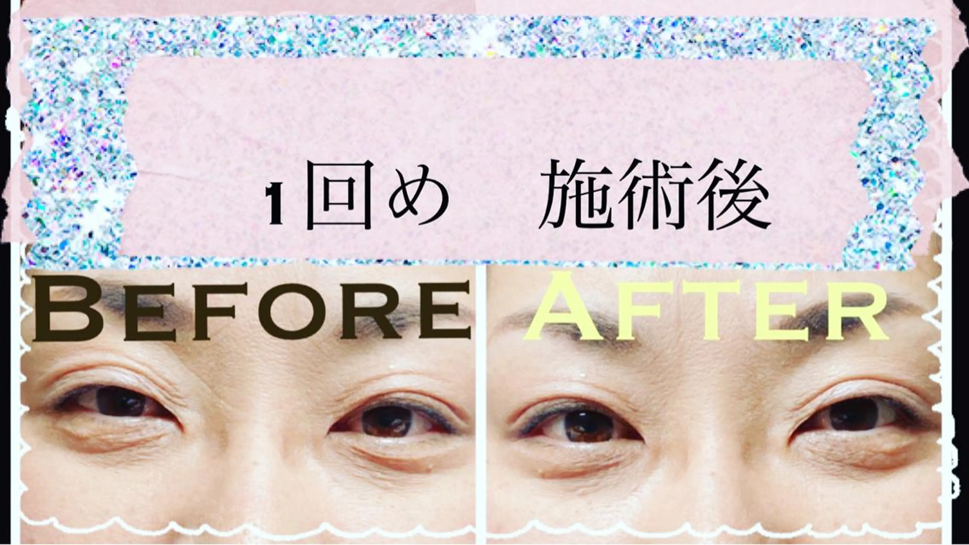 Anne’s happyBonesのエステ・リラクイメージ