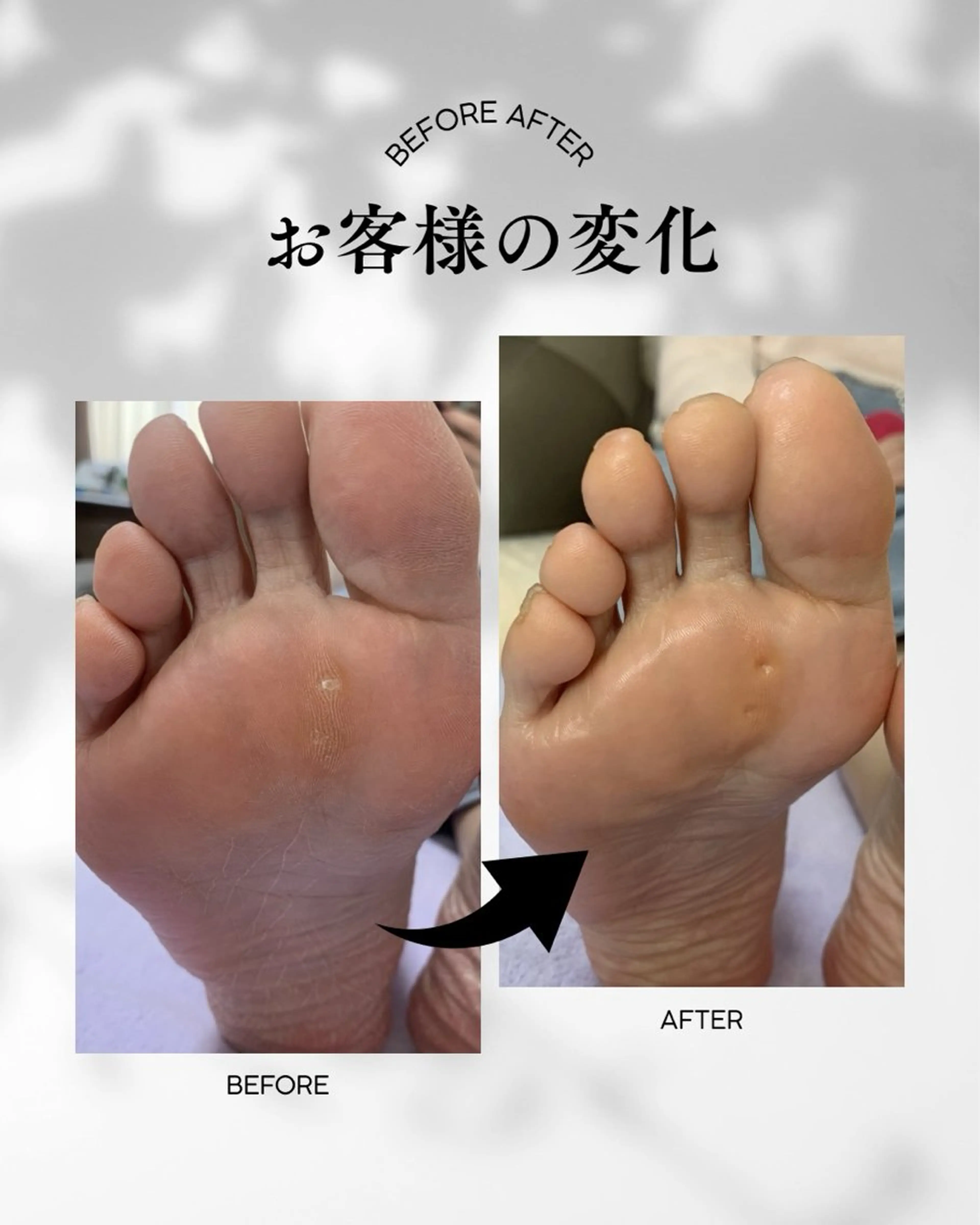 メンズ 【足トラブル専門店】魚の目・巻き爪 フットケアサロン　ニコルル金沢店所属・足トラブル専門 ニコルル金沢のエステ・リラクイメージ