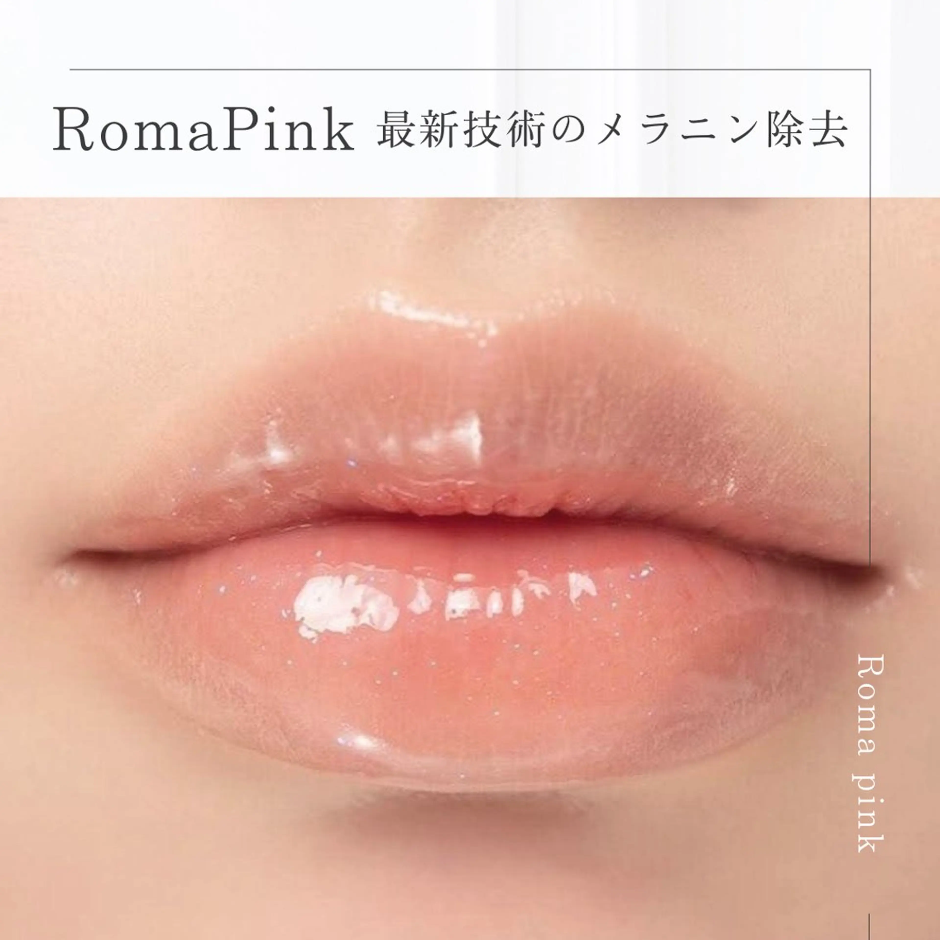 小顔/たるみ/黒ずみ除去専門サロン/SONA 大和西大寺店所属・【小顔専門看護師 サロンSONA】のエステ・リラクイメージ