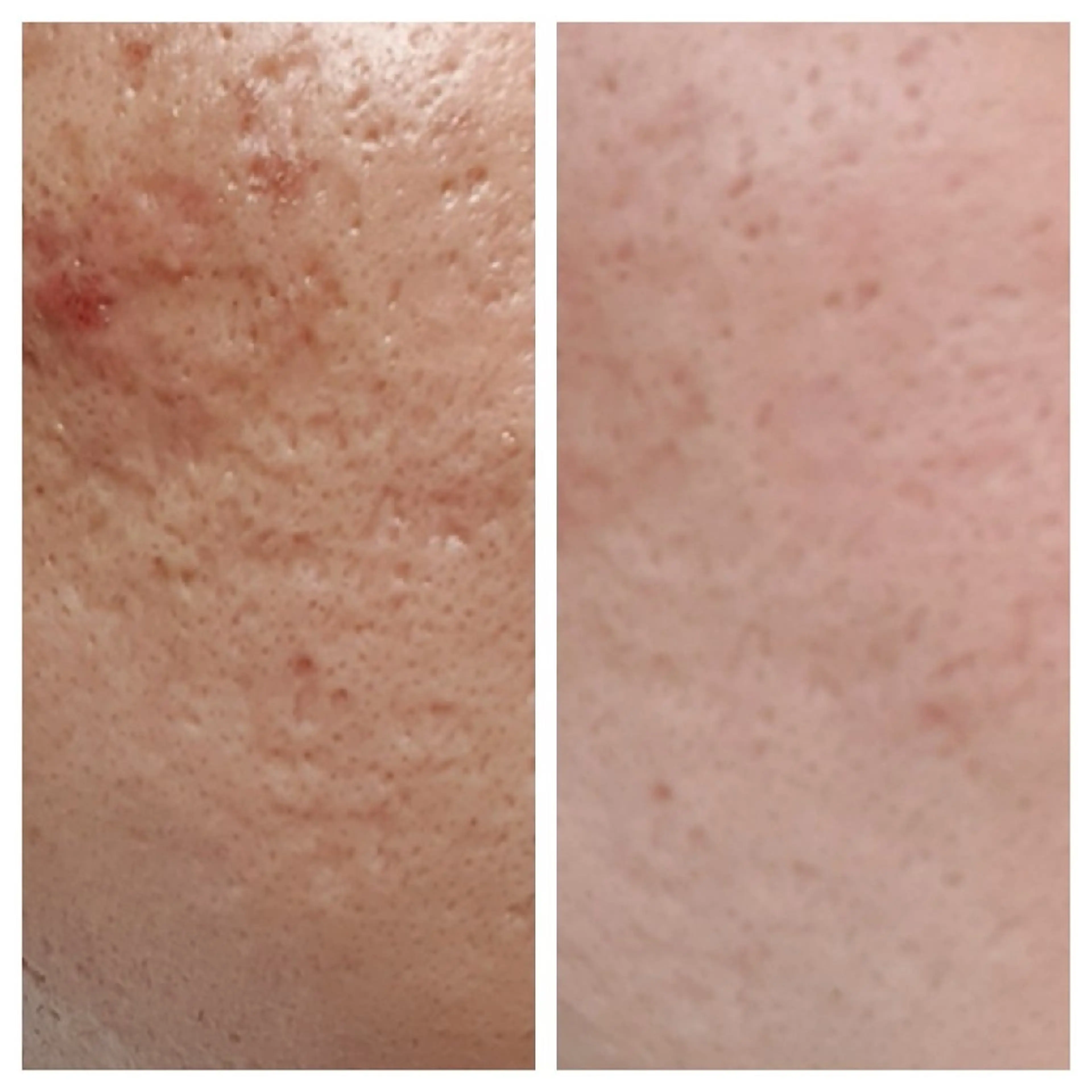 整体エステ　NEW ME所属・深層リンパオイル/小 顔とドライヘッドスパのエステ・リラクイメージ