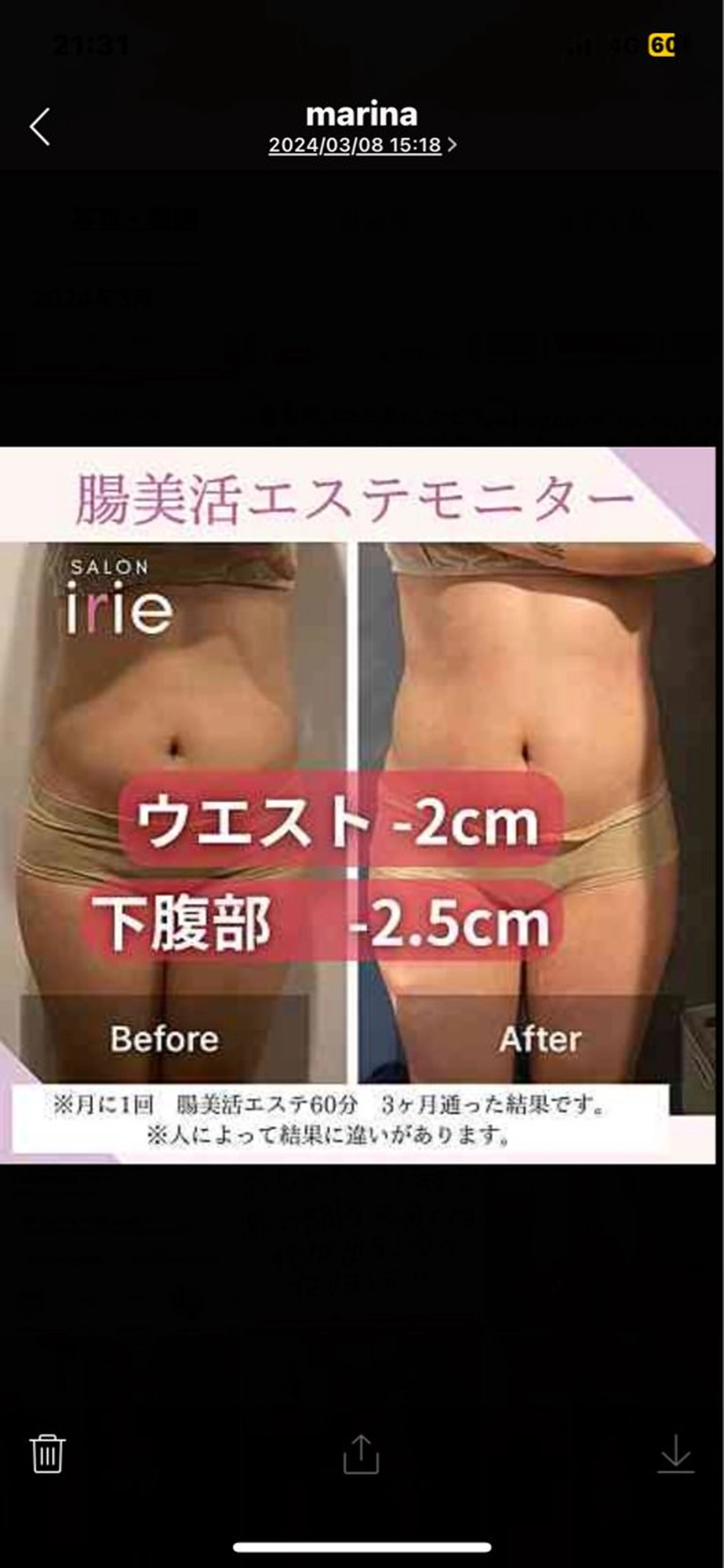 腸活/クビレを作る /痩身エステのエステ・リラクイメージ